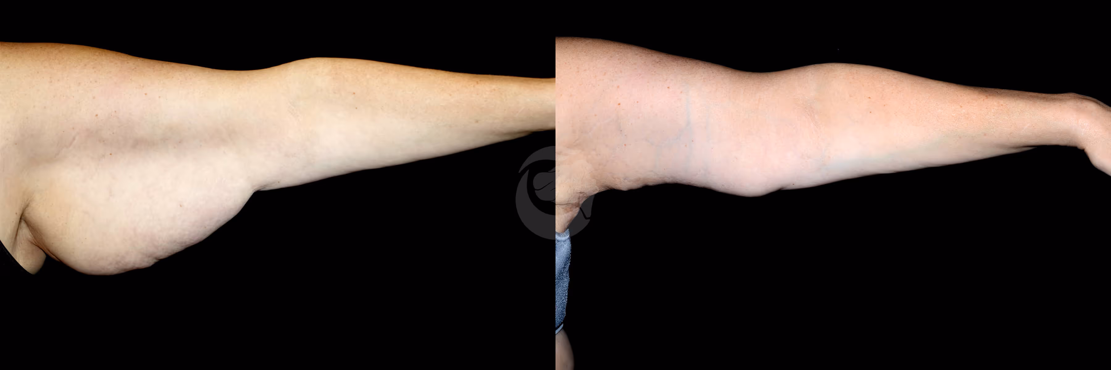 Before And After Patient Image