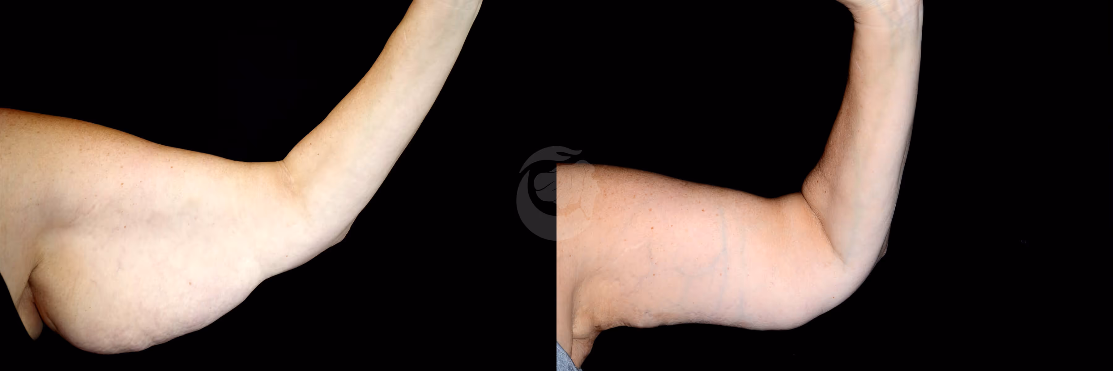 Before And After Patient Image