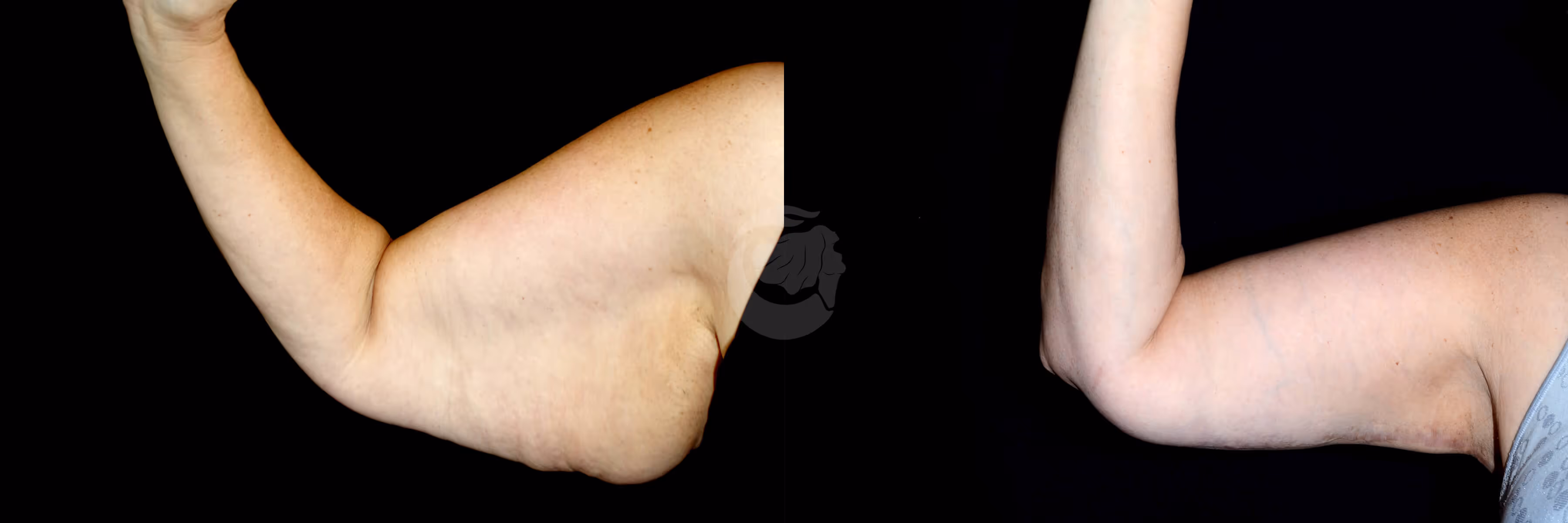 Before And After Patient Image