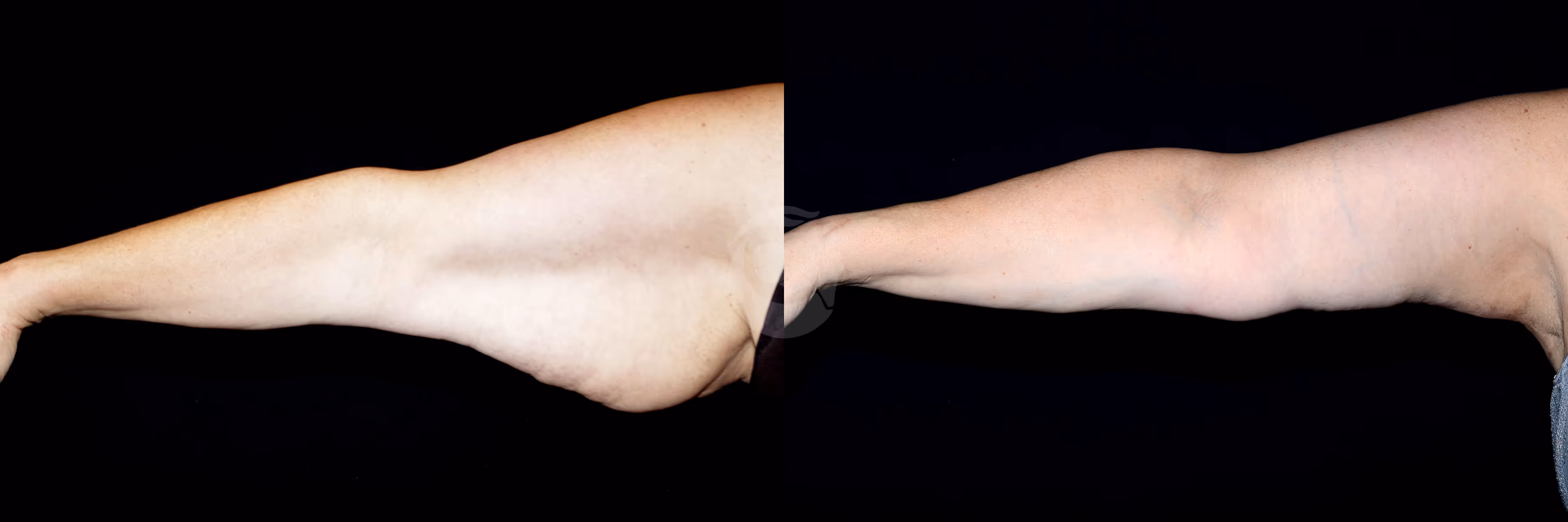 Before And After Patient Image