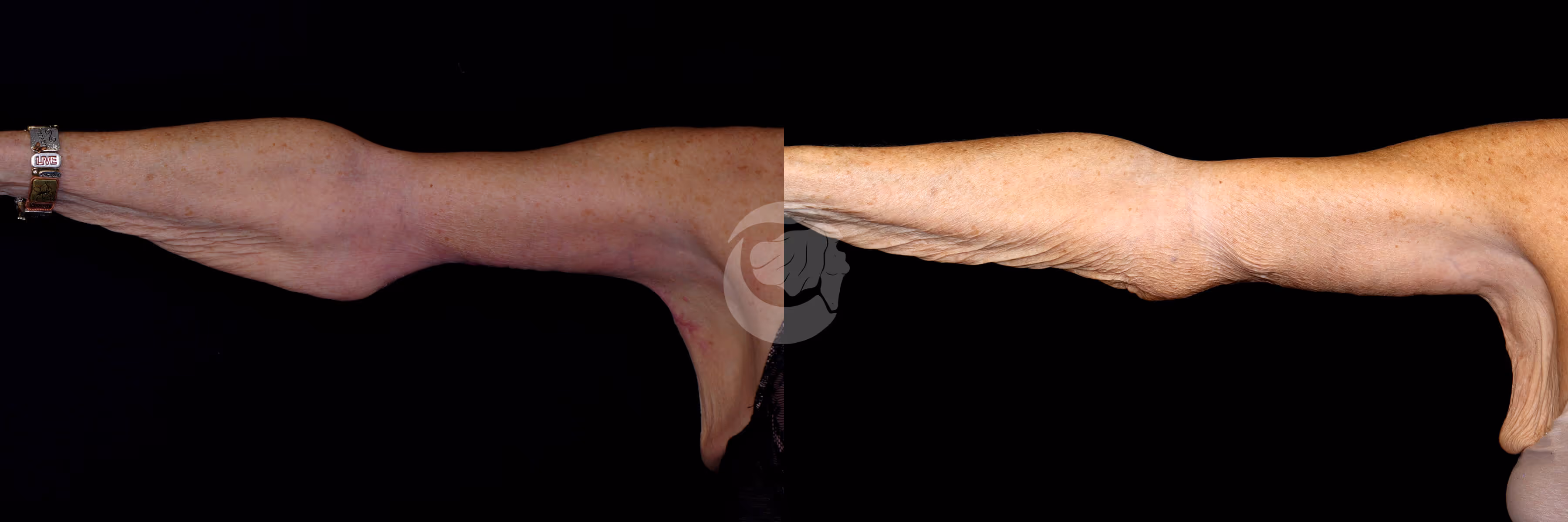 Before And After Patient Image