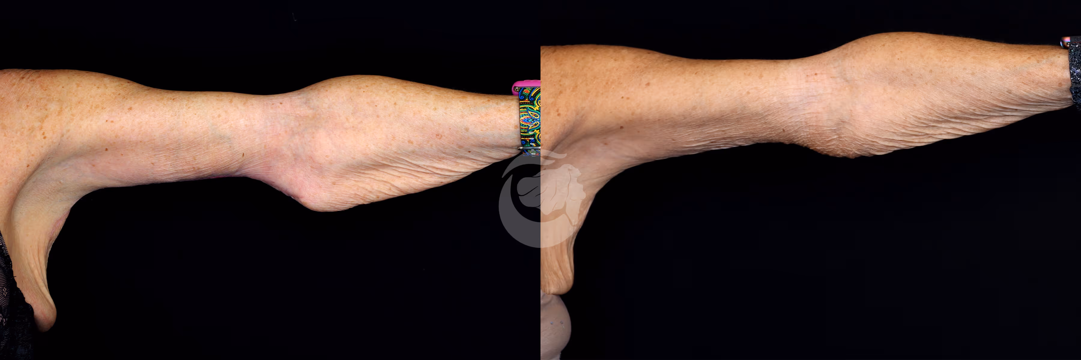 Before And After Patient Image