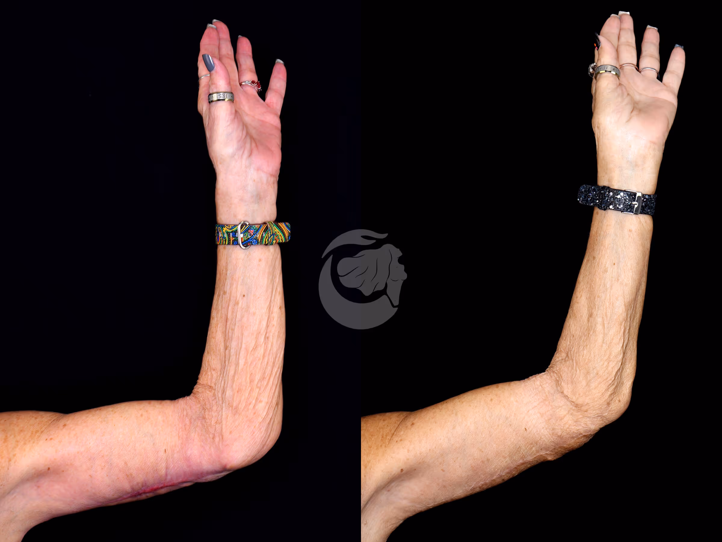 Before And After Patient Image