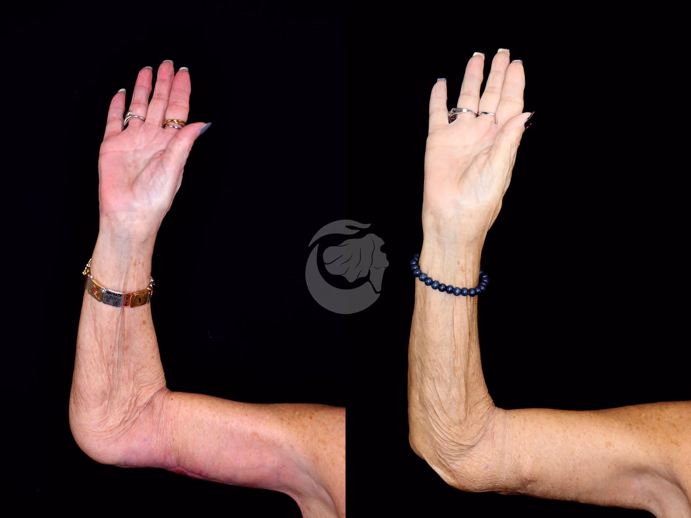Before And After Patient Image
