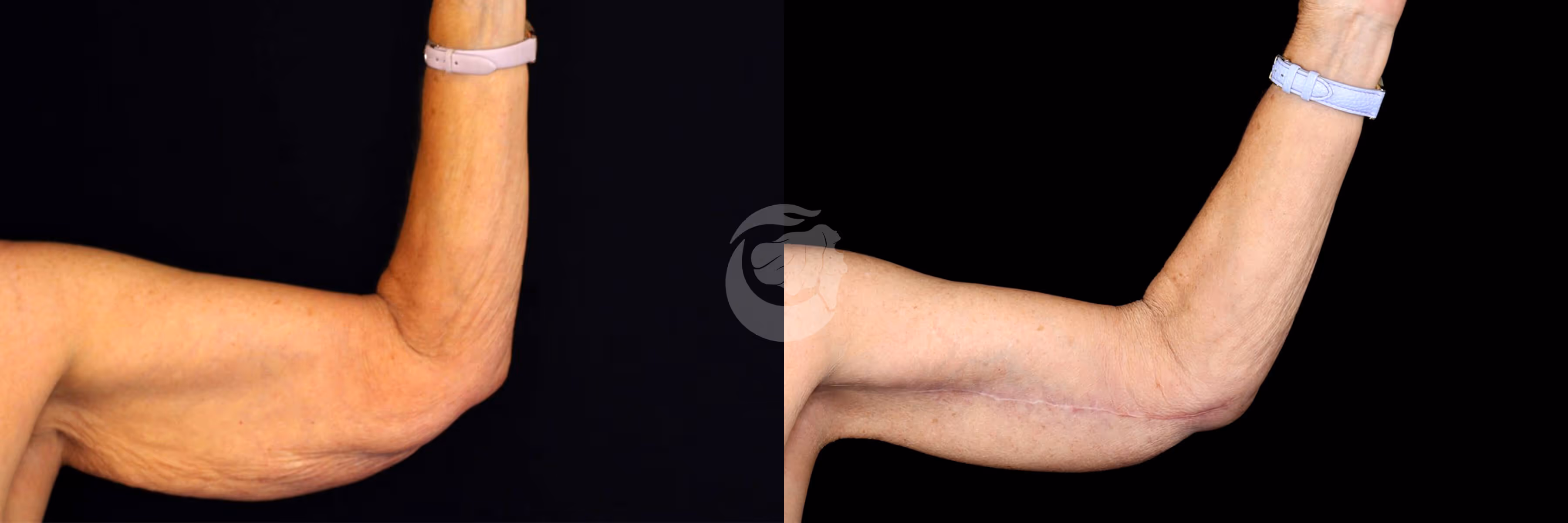 Before And After Patient Image