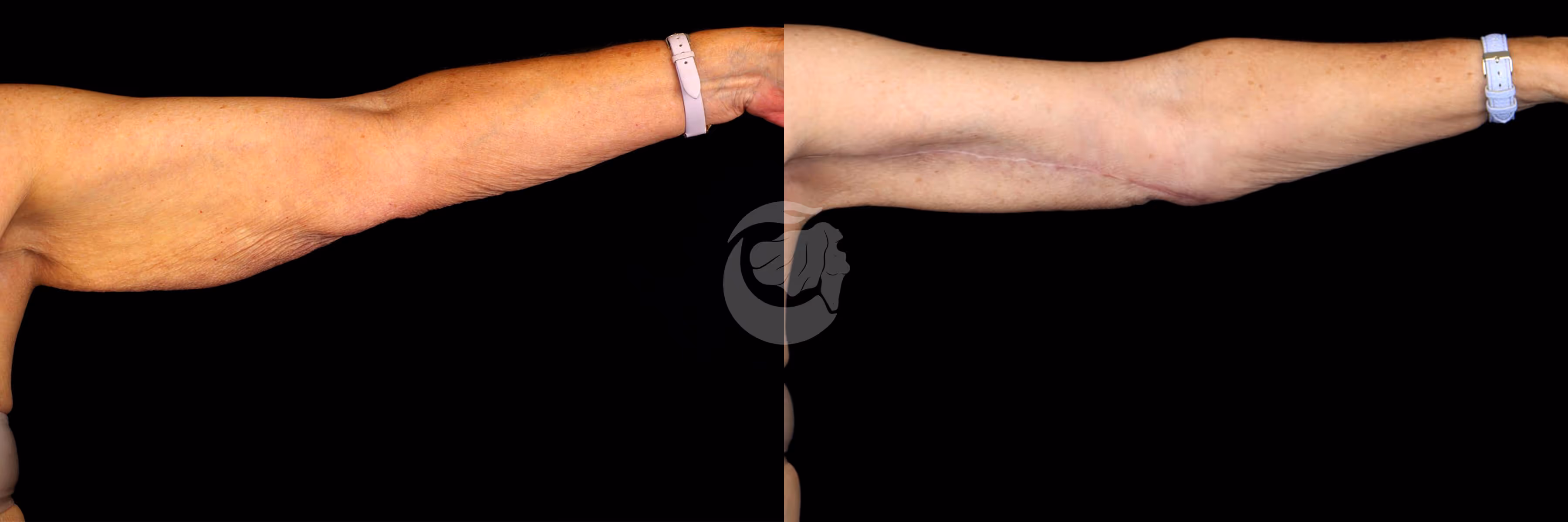 Before And After Patient Image