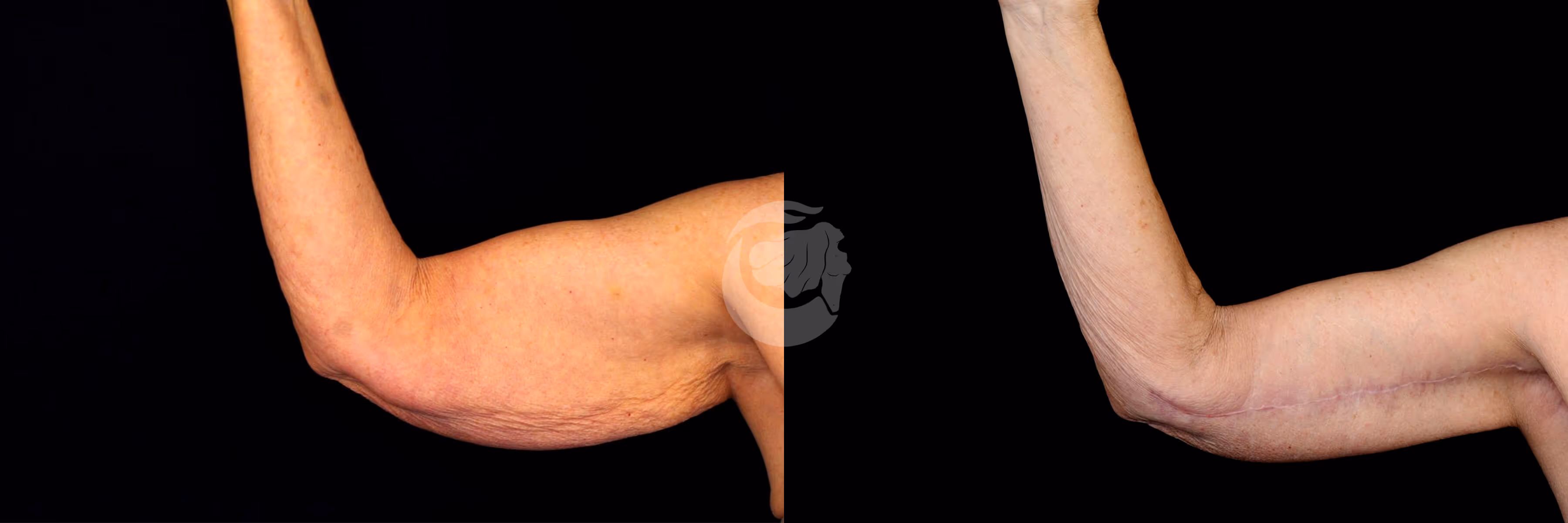 Before And After Patient Image