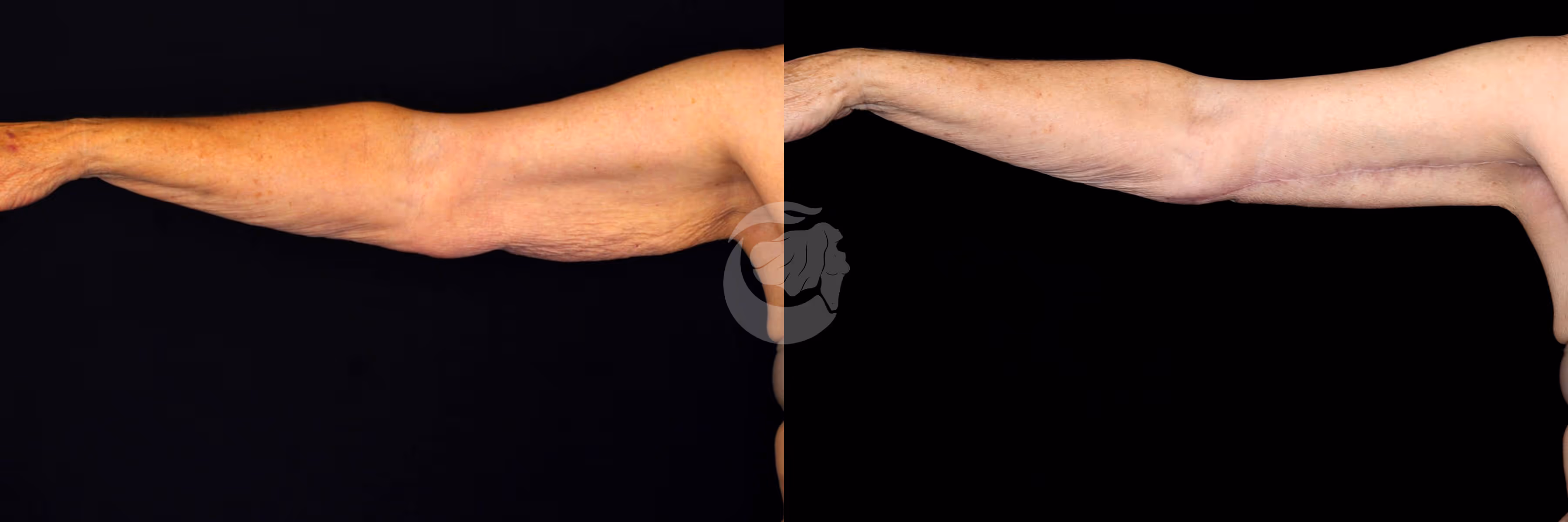 Before And After Patient Image
