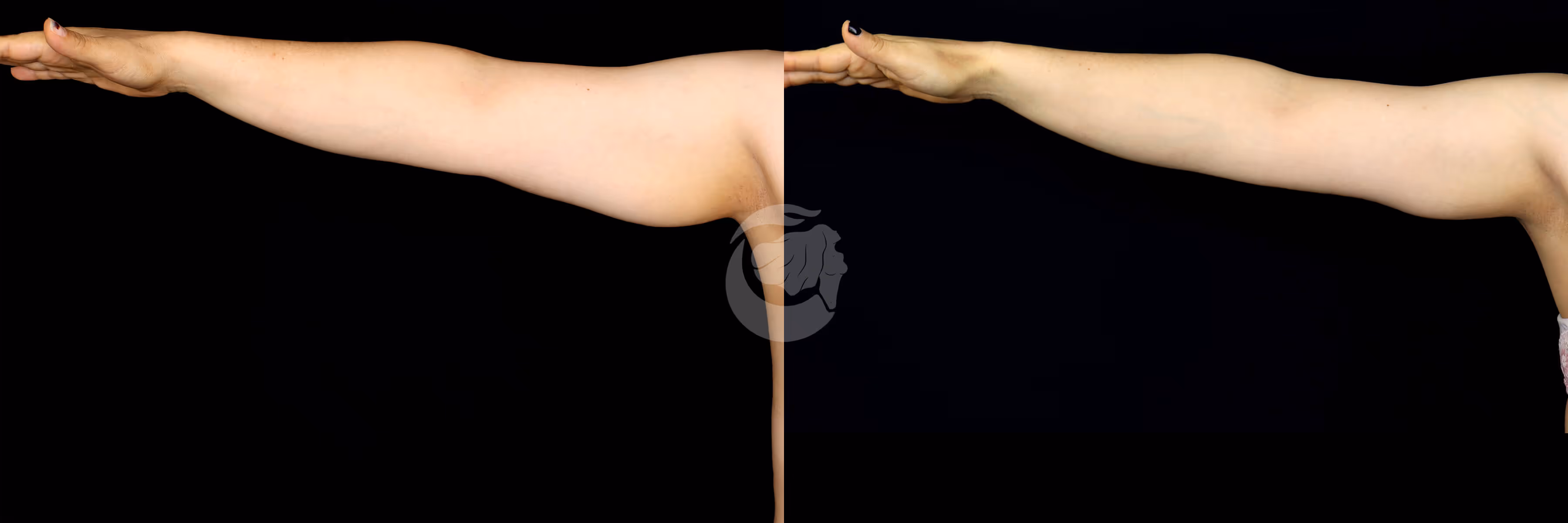 Before And After Patient Image