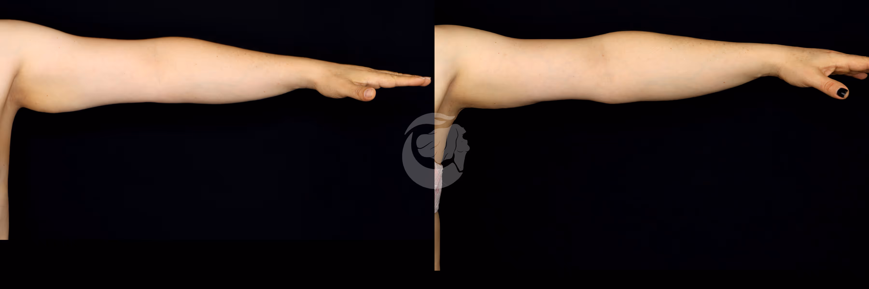 Before And After Patient Image