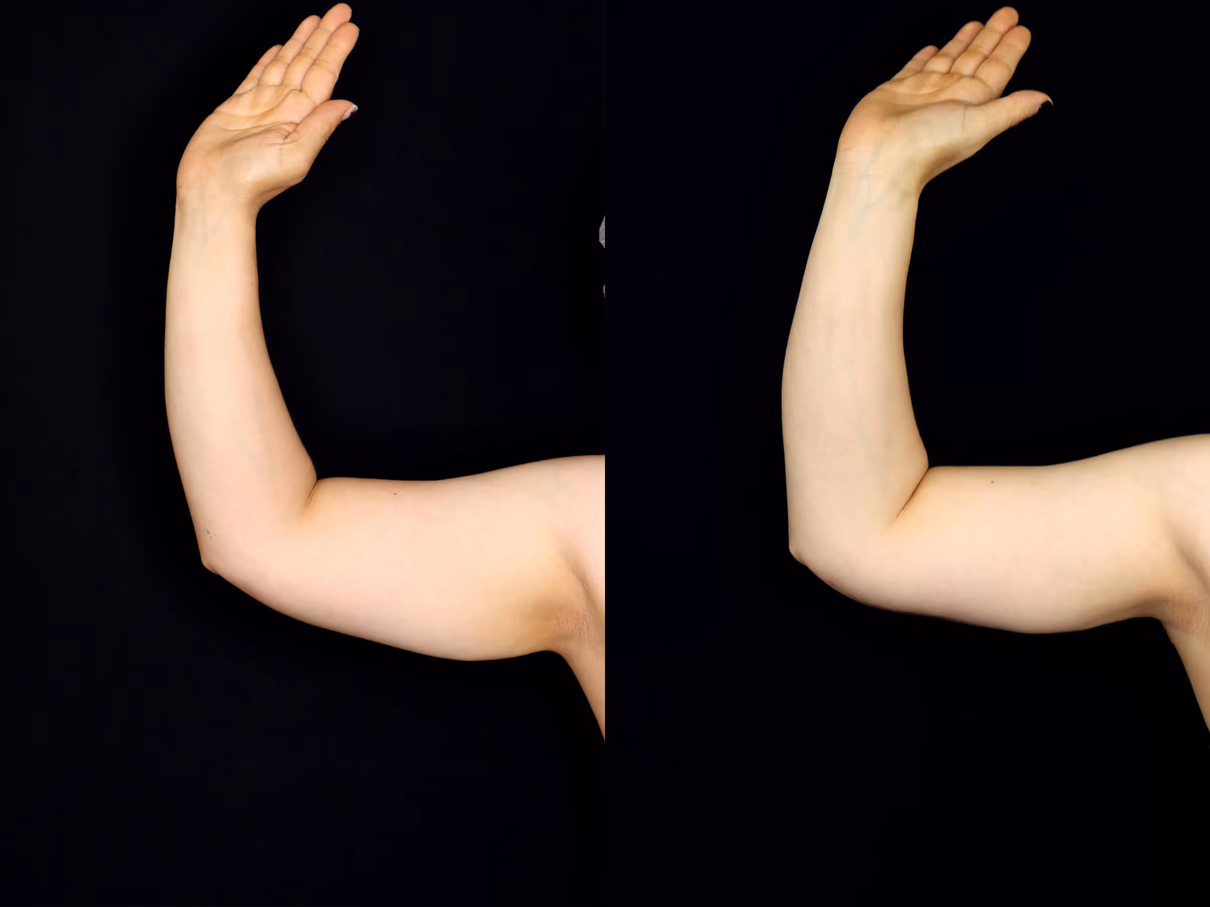 Before And After Patient Image