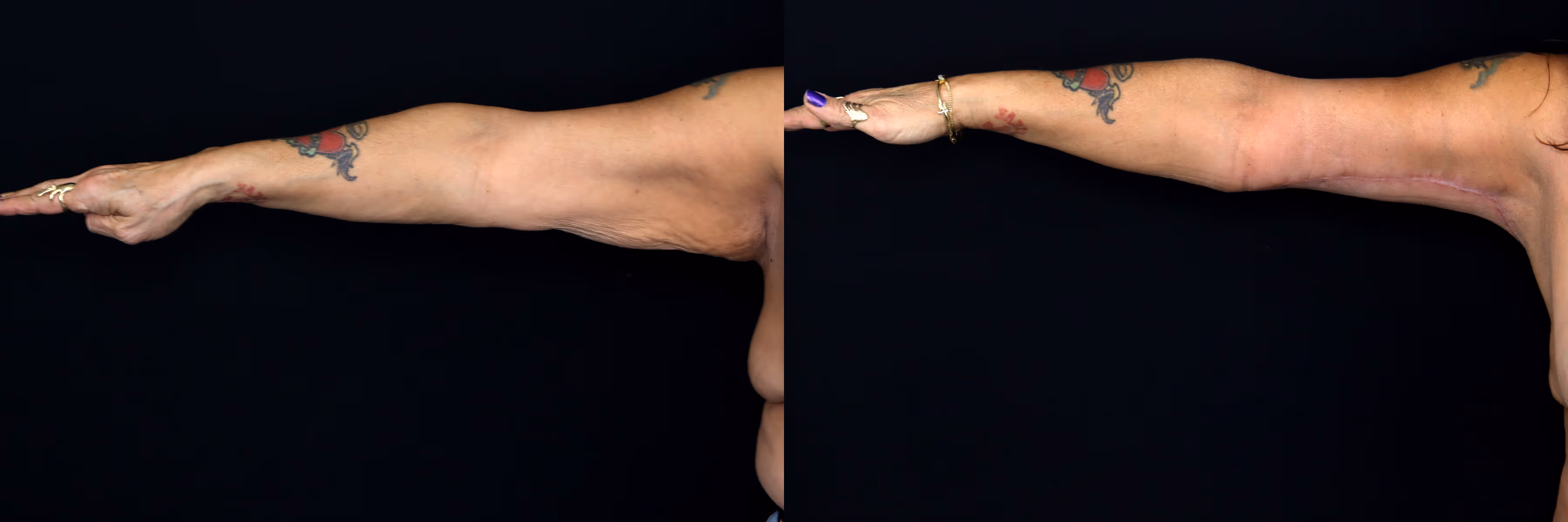 Before And After Patient Image