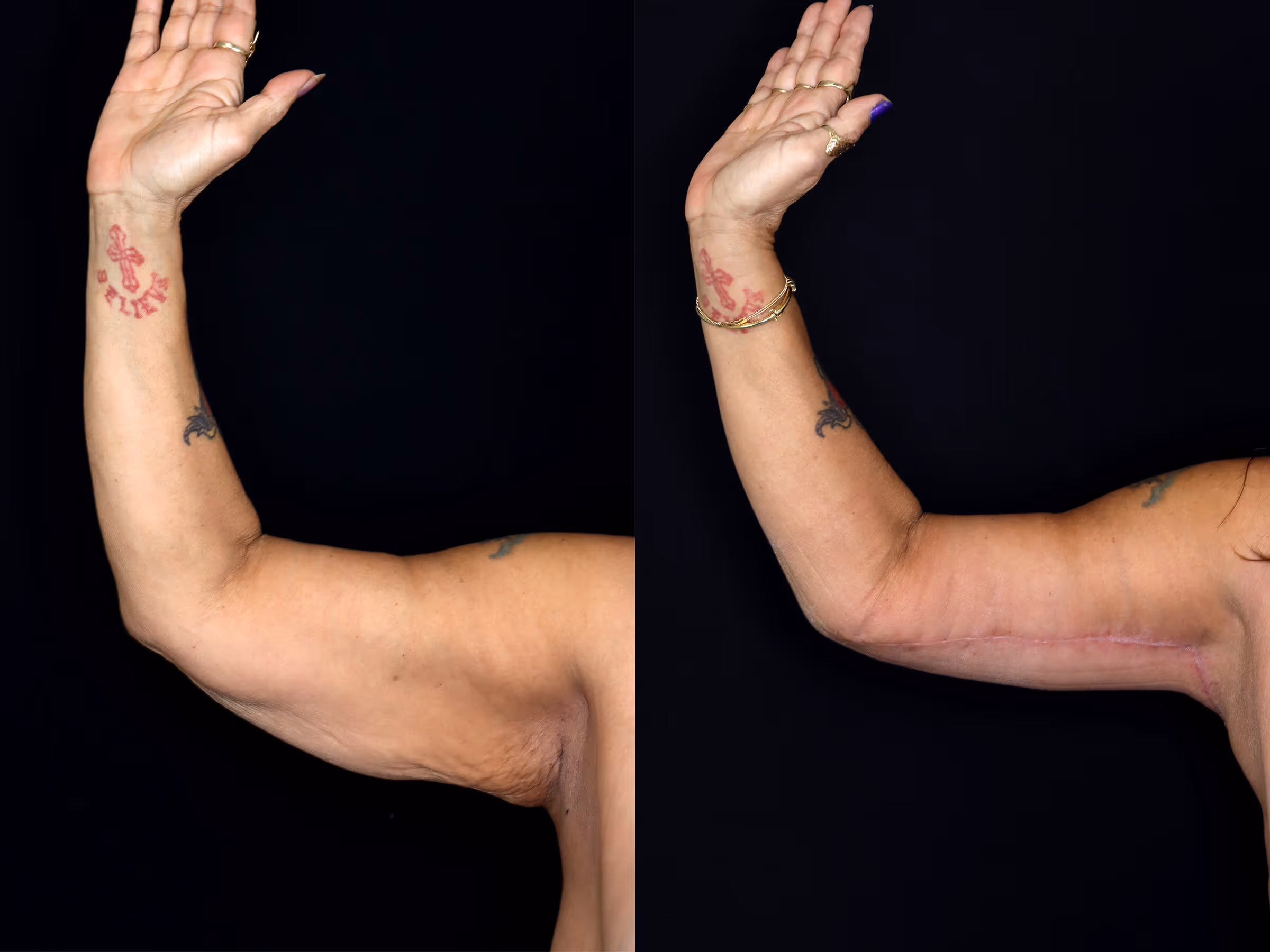 Before And After Patient Image