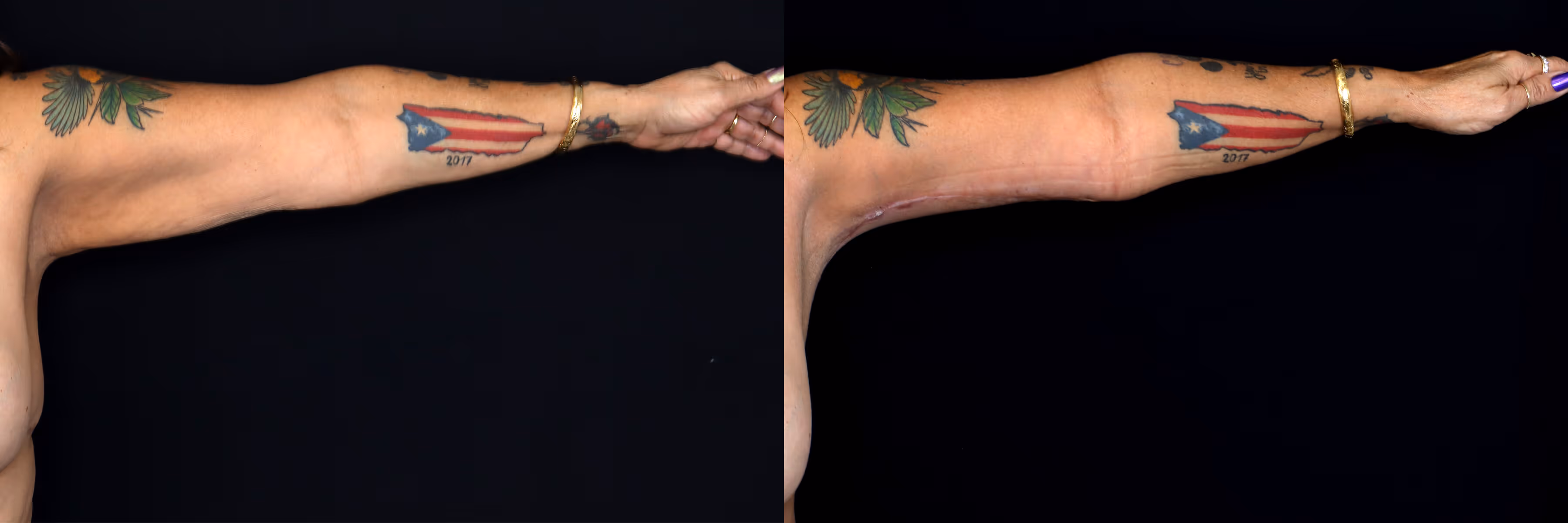 Before And After Patient Image