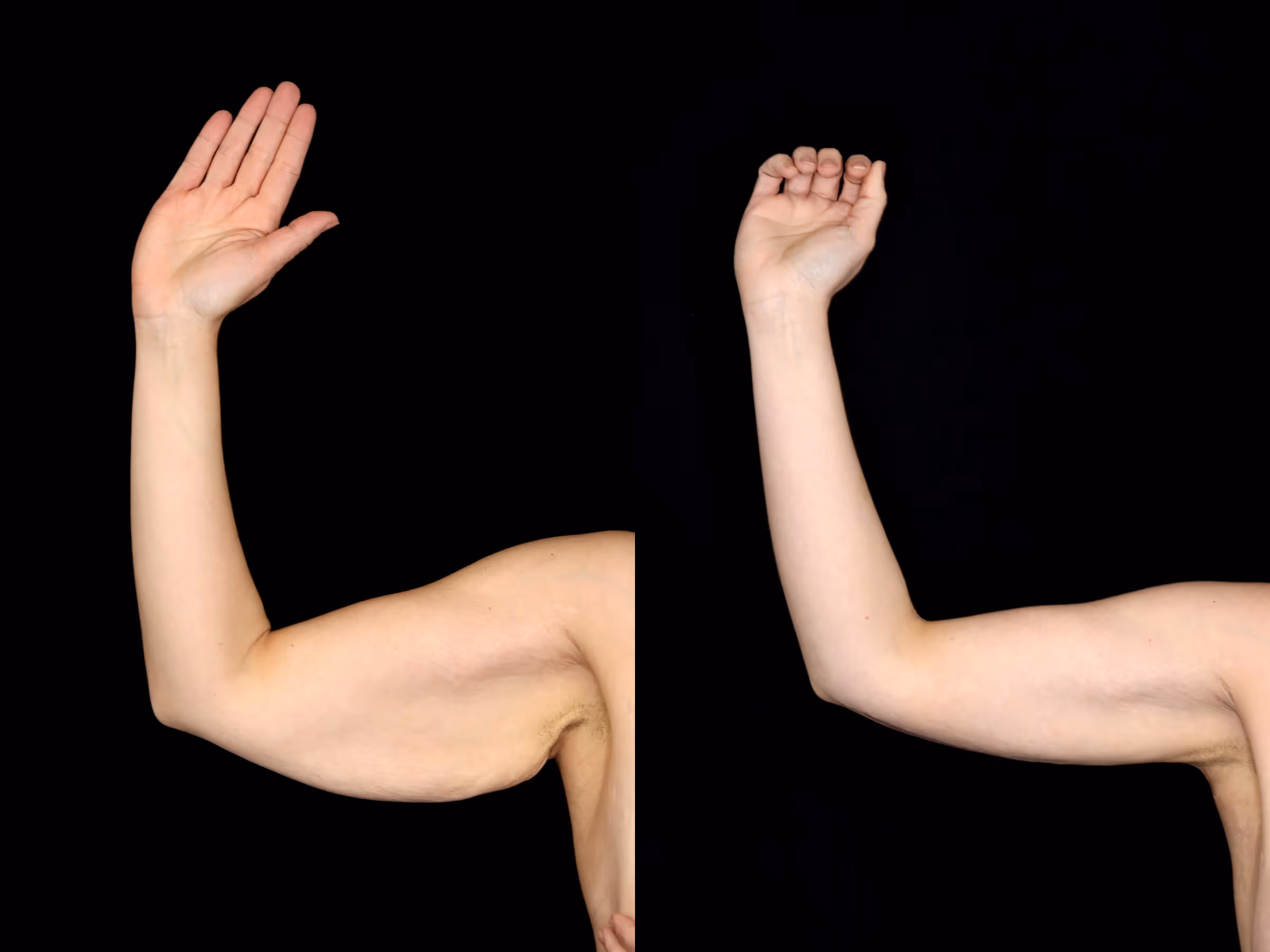 Before And After Patient Image