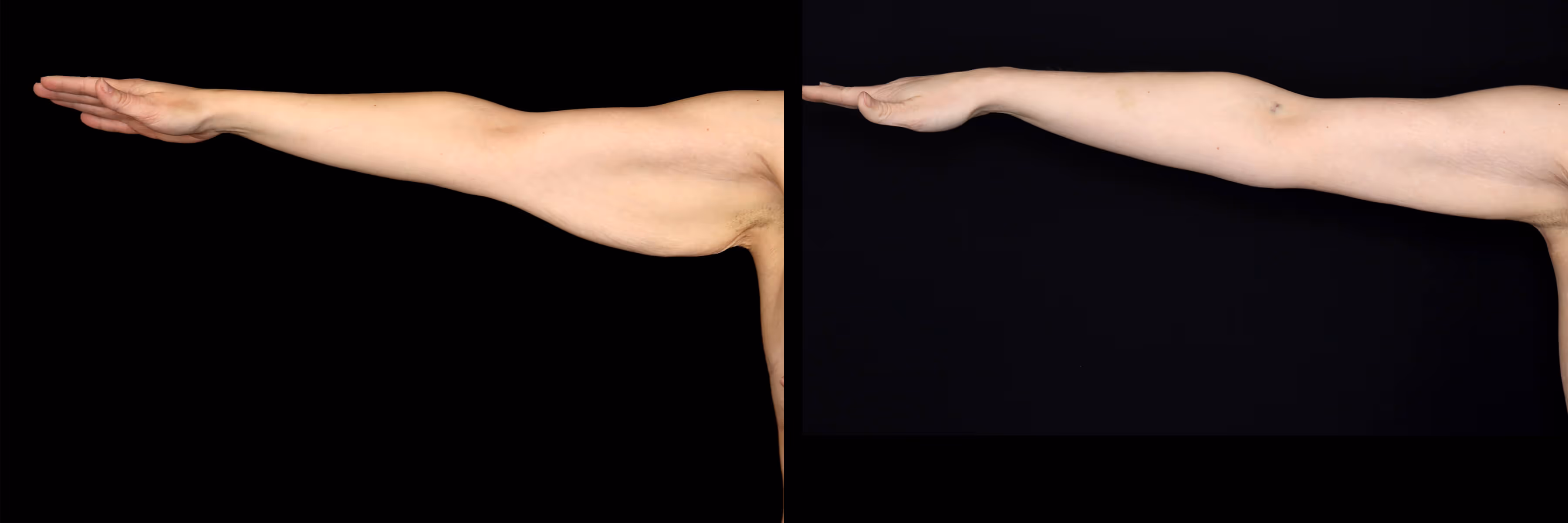 Before And After Patient Image