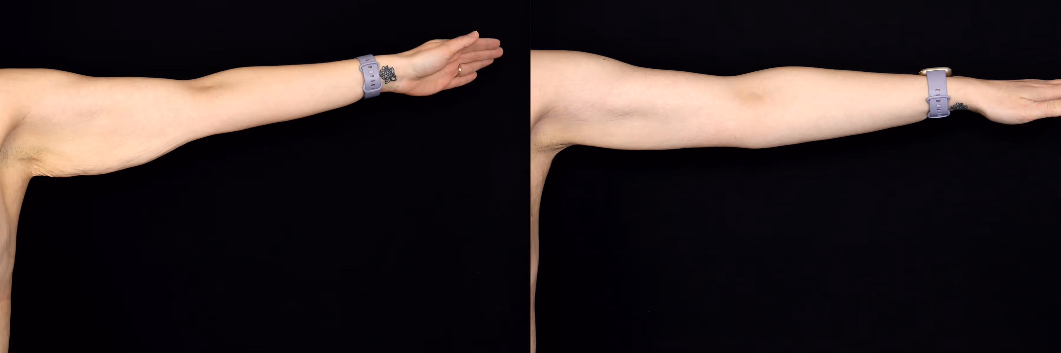 Before And After Patient Image