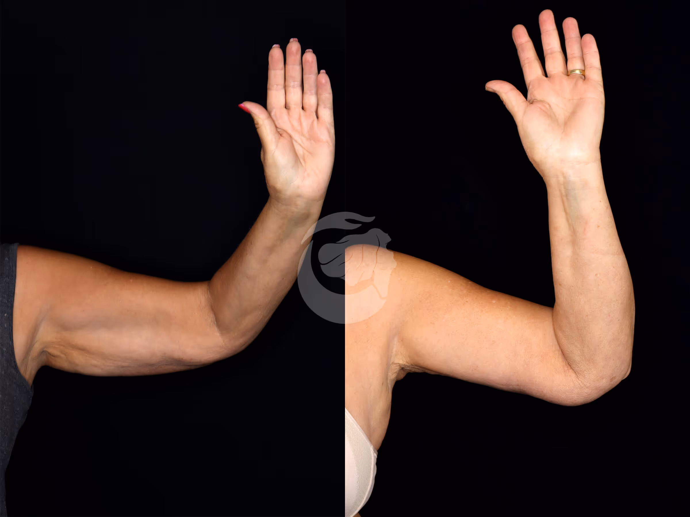 Before And After Patient Image