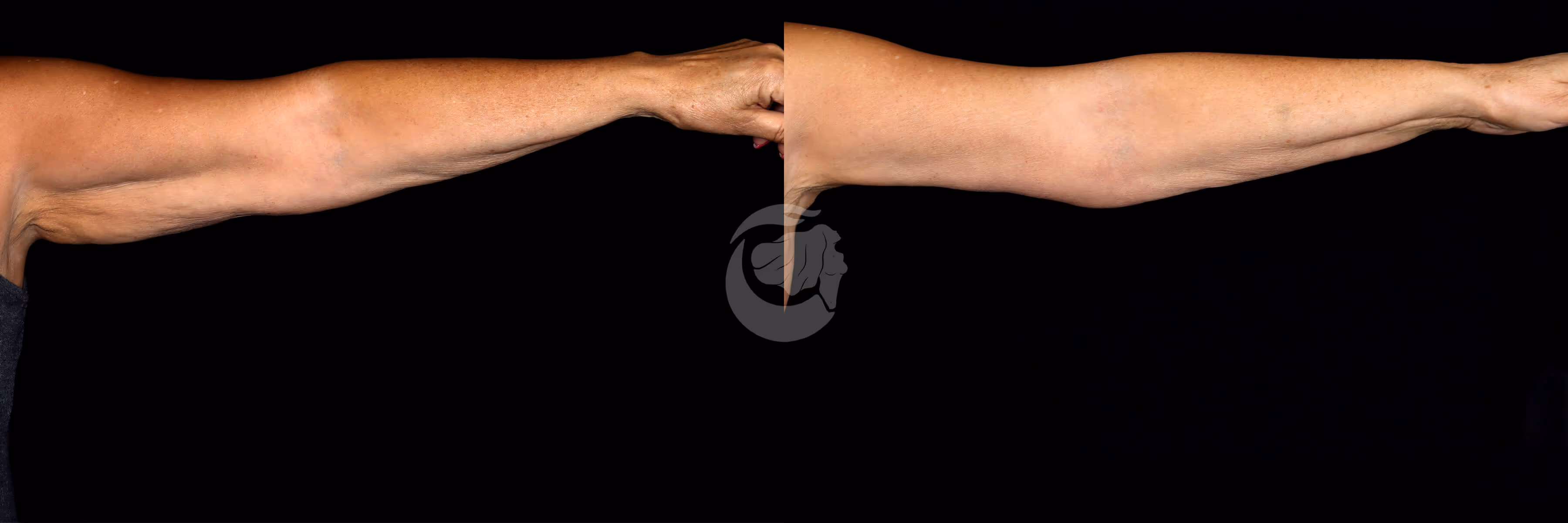 Before And After Patient Image