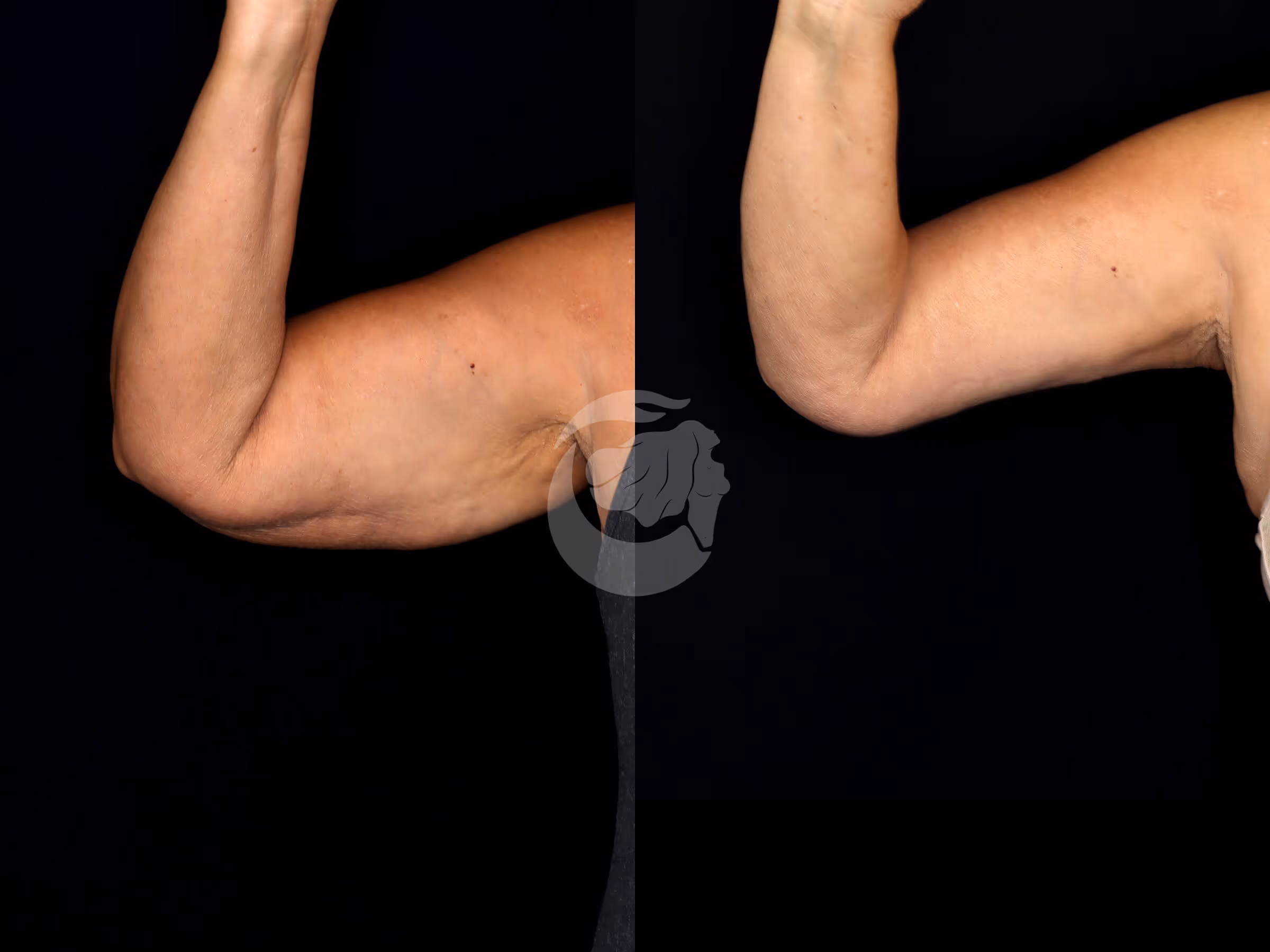 Before And After Patient Image