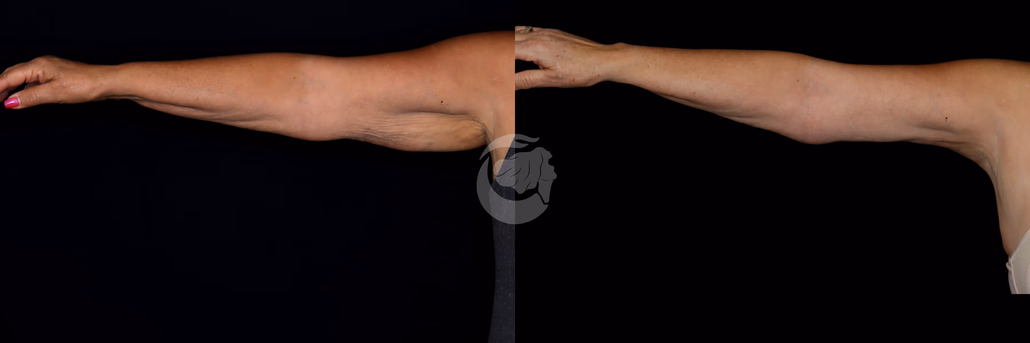 Before And After Patient Image