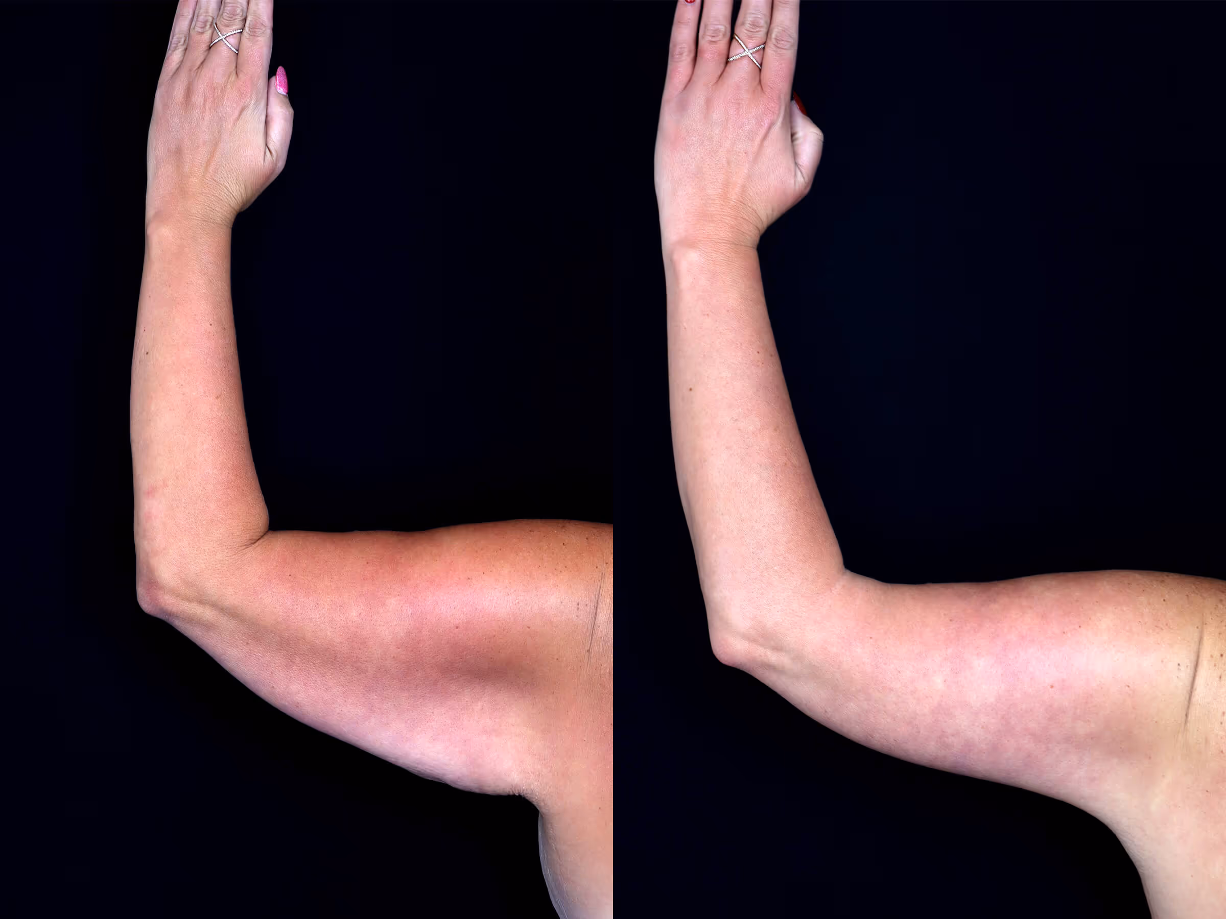 Before And After Patient Image