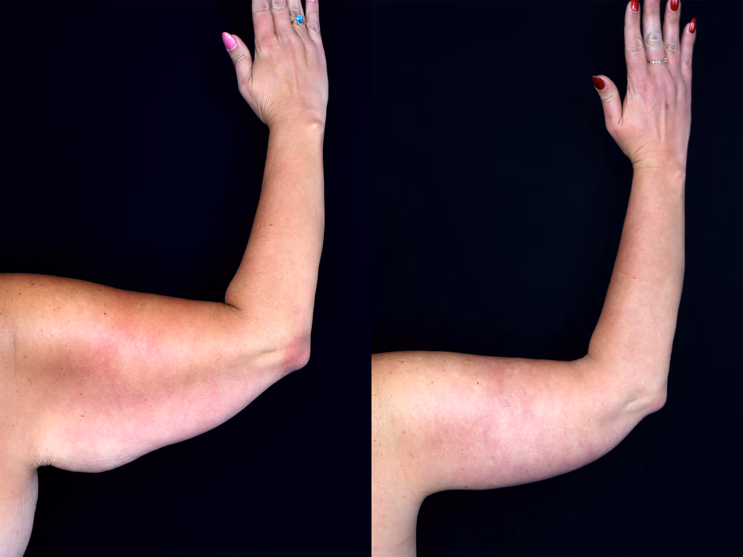 Before And After Patient Image