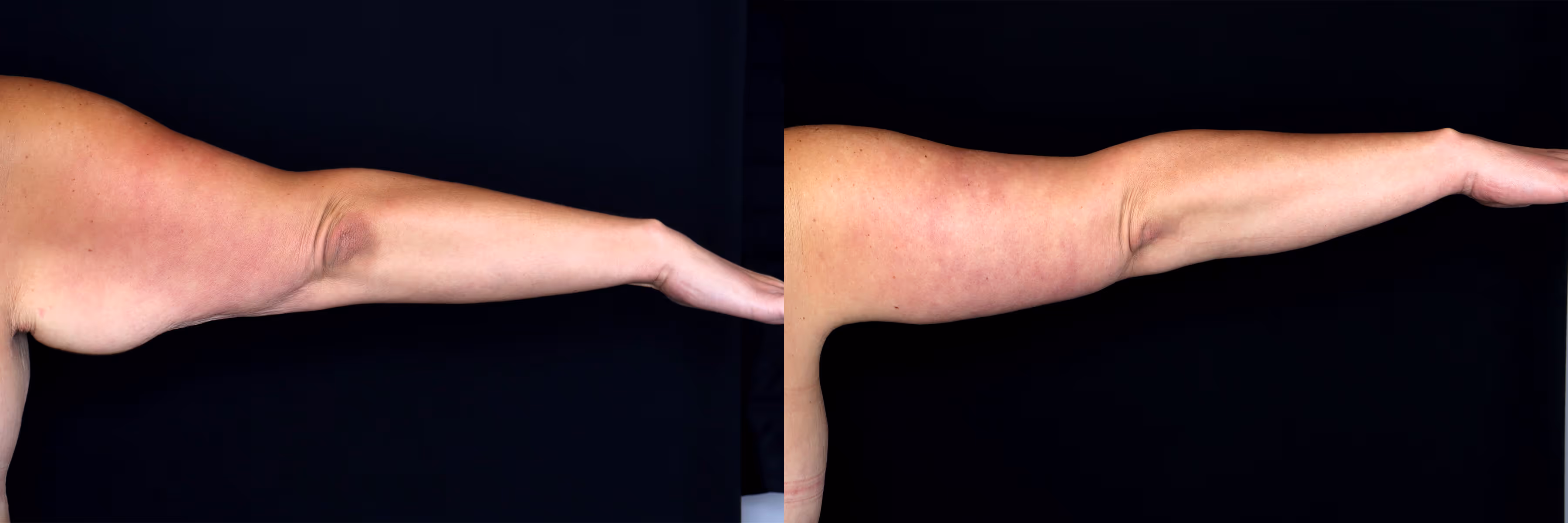 Before And After Patient Image
