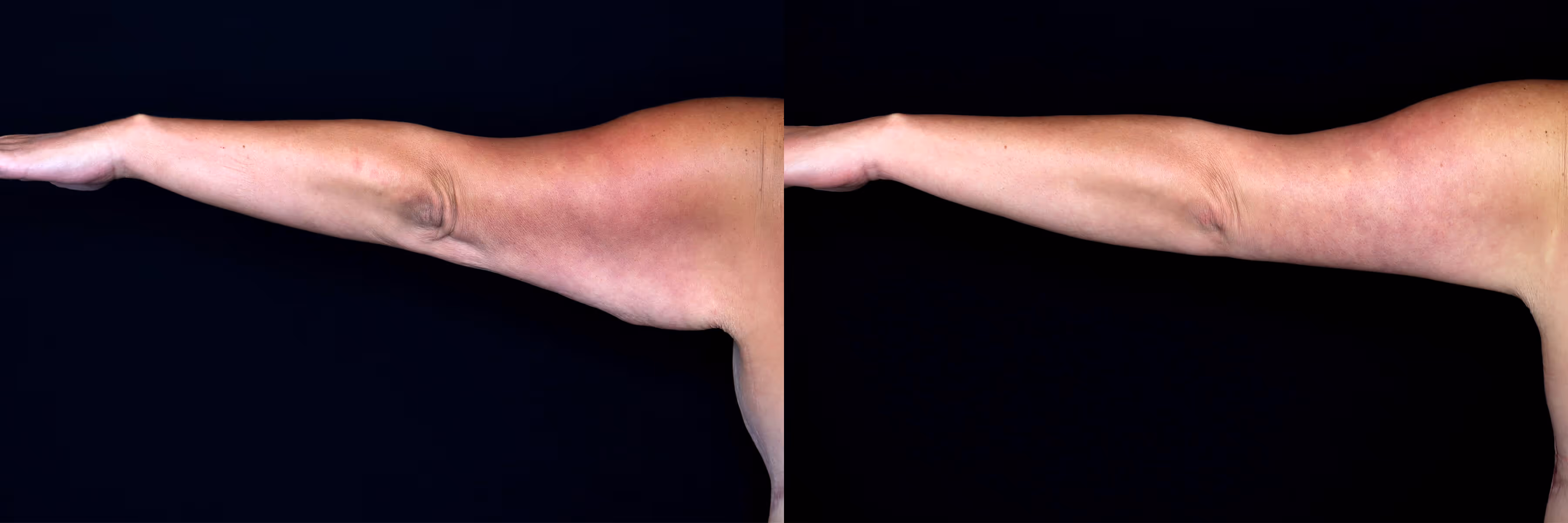 Before And After Patient Image