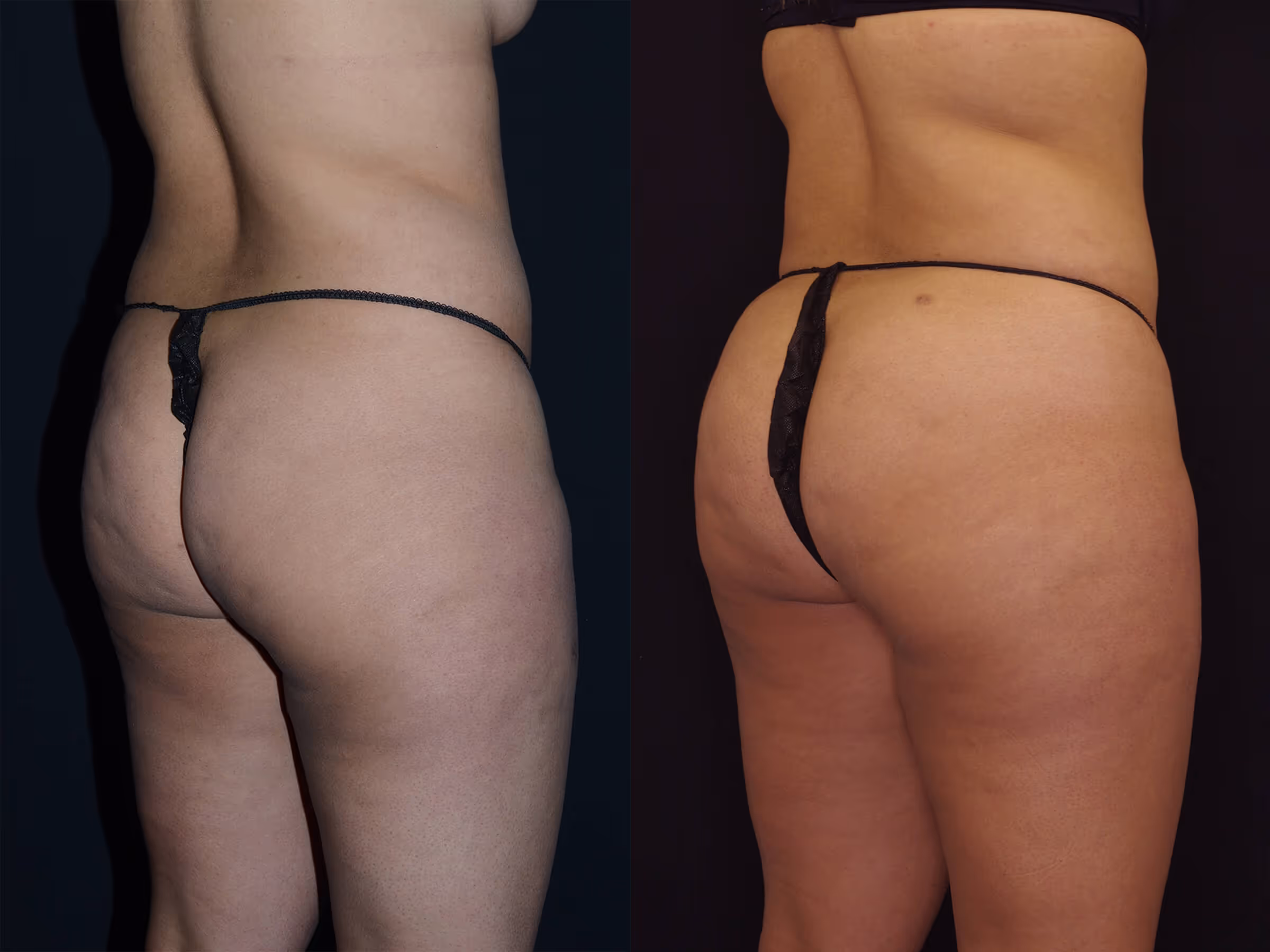 Before And After Patient Image