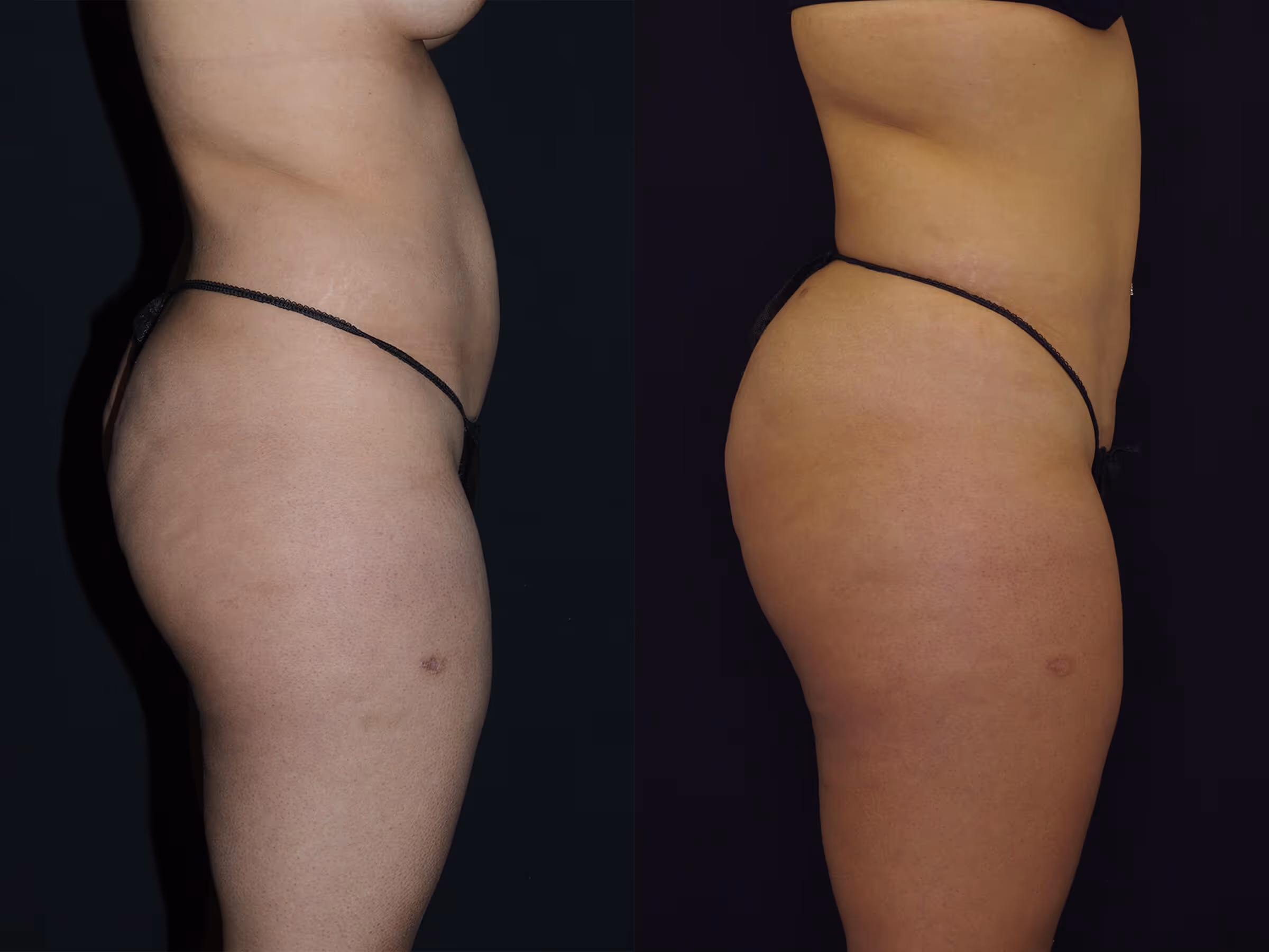 Before And After Patient Image