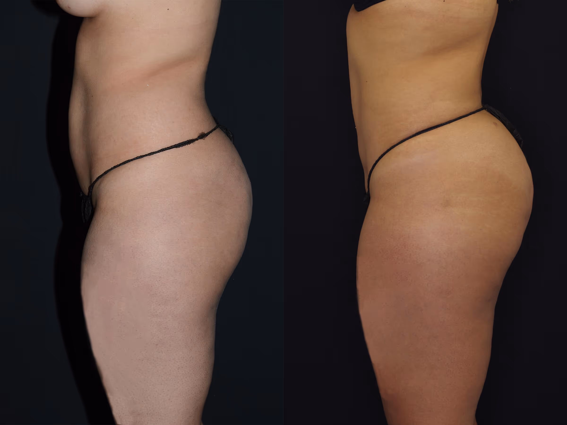 Before And After Patient Image