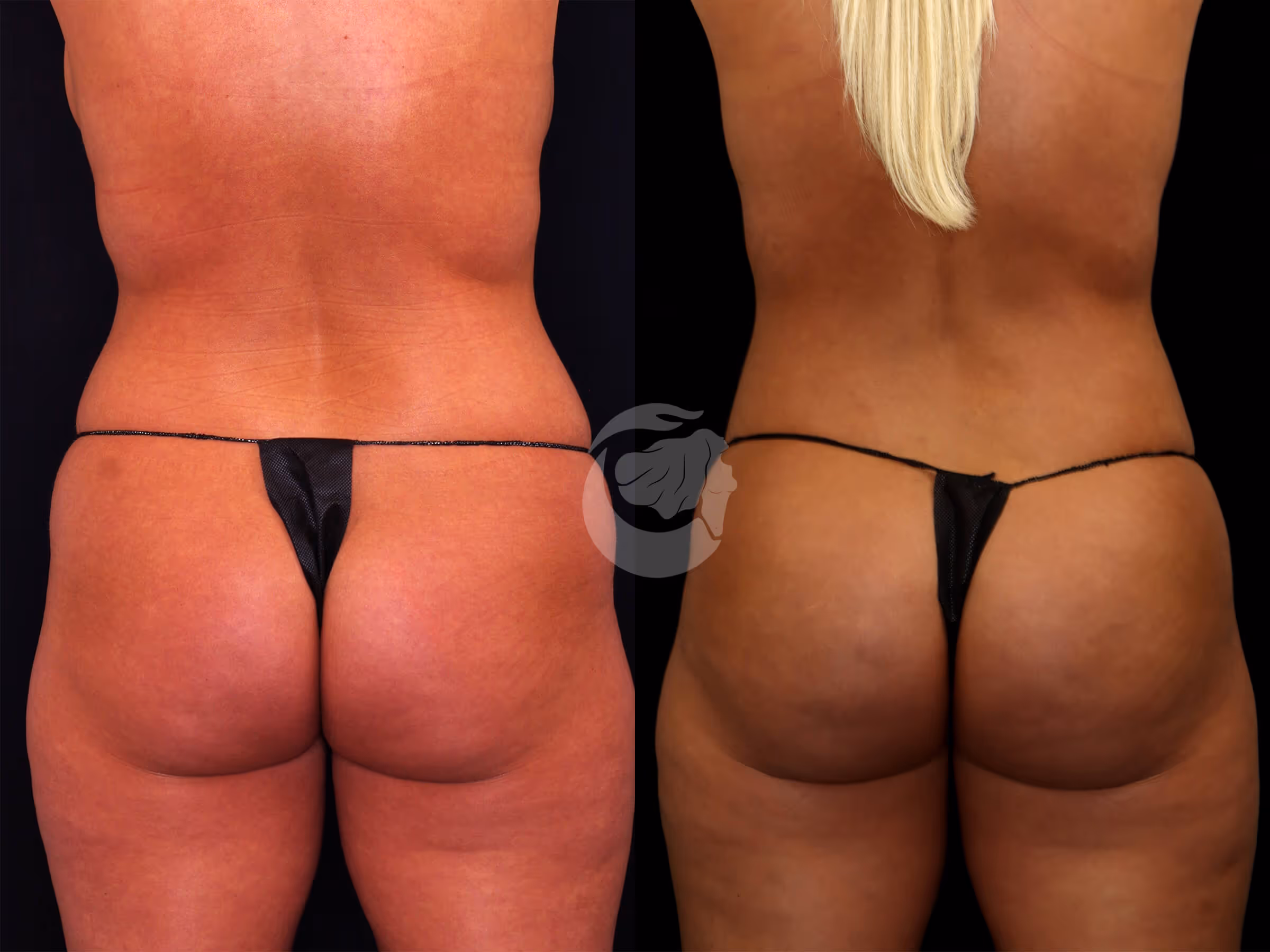 Before And After Patient Image