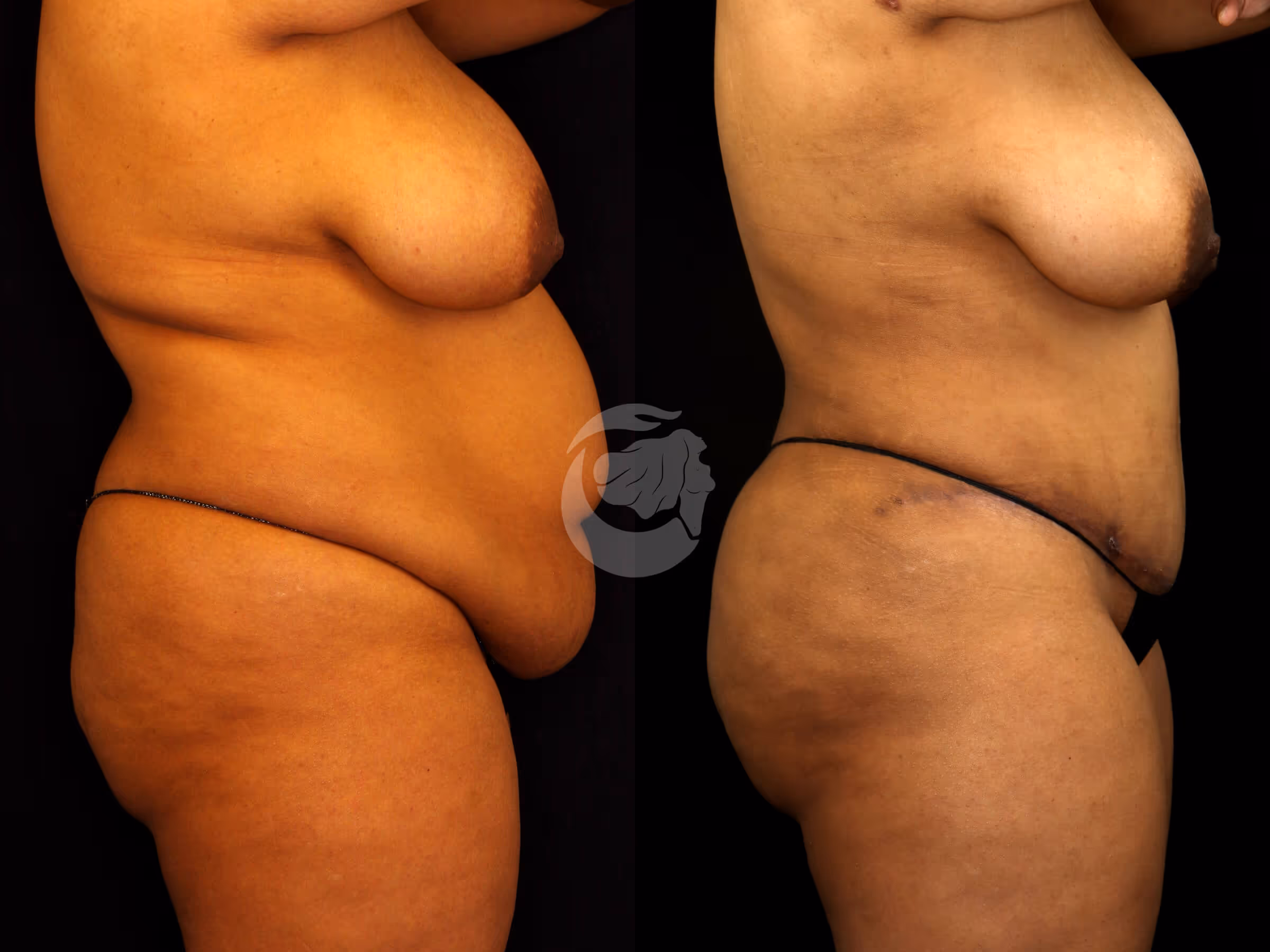 Before And After Patient Image