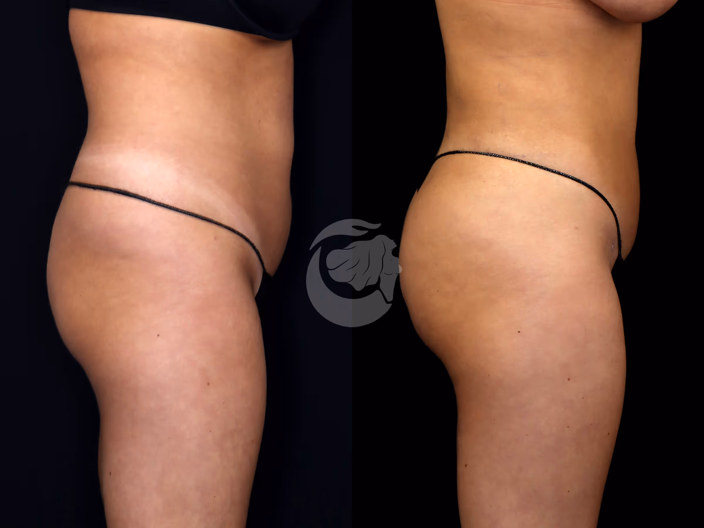 Before And After Patient Image