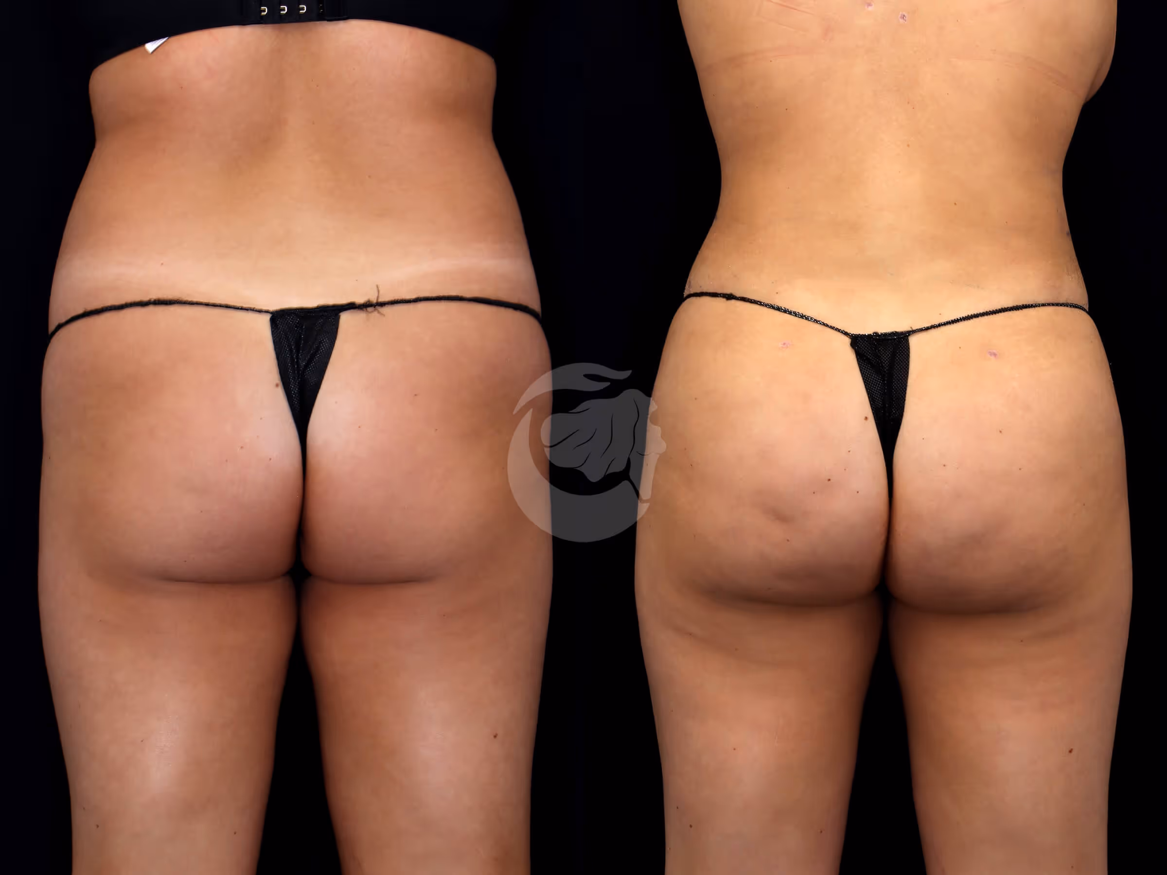 Before And After Patient Image