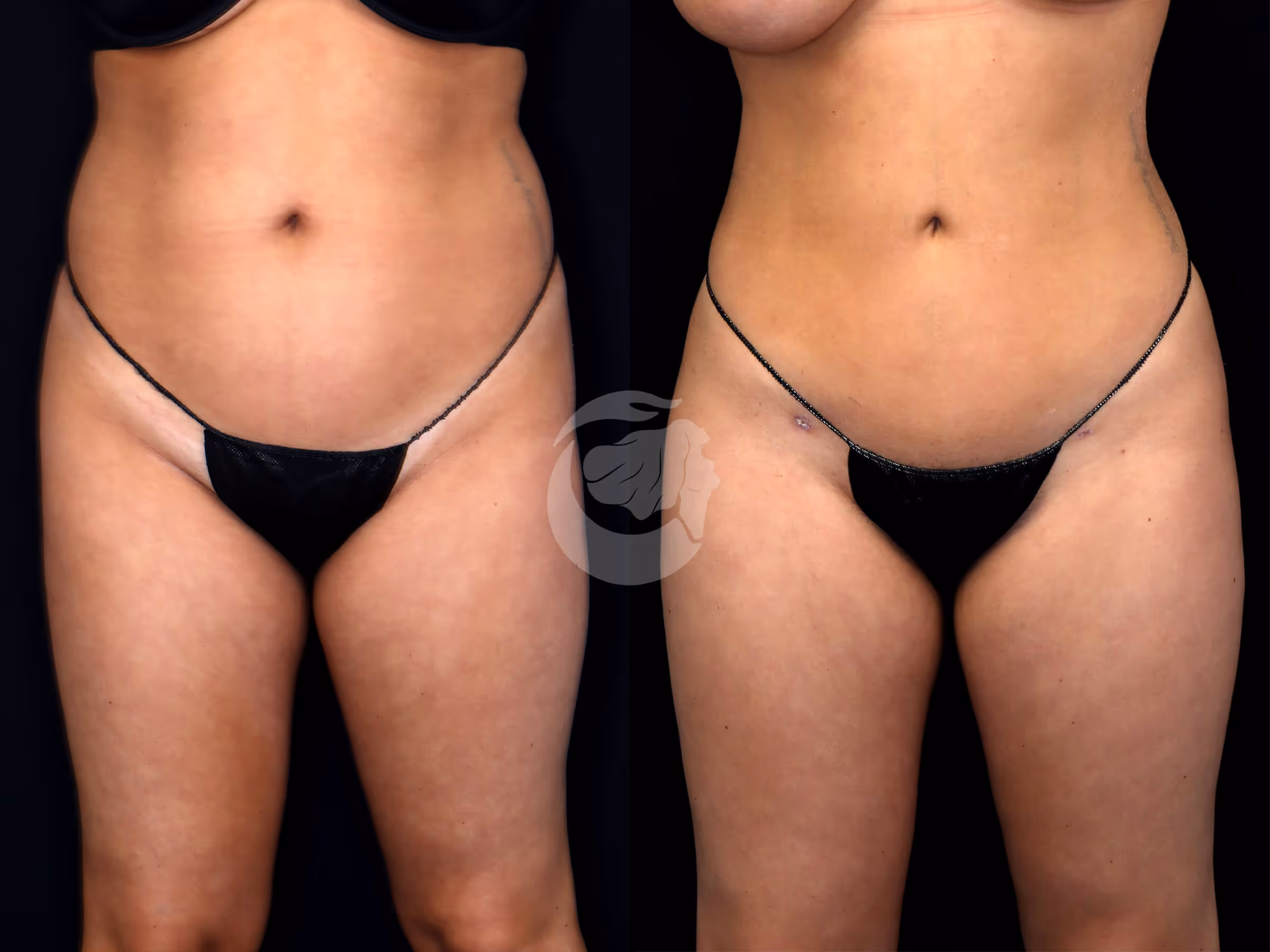 Before And After Patient Image