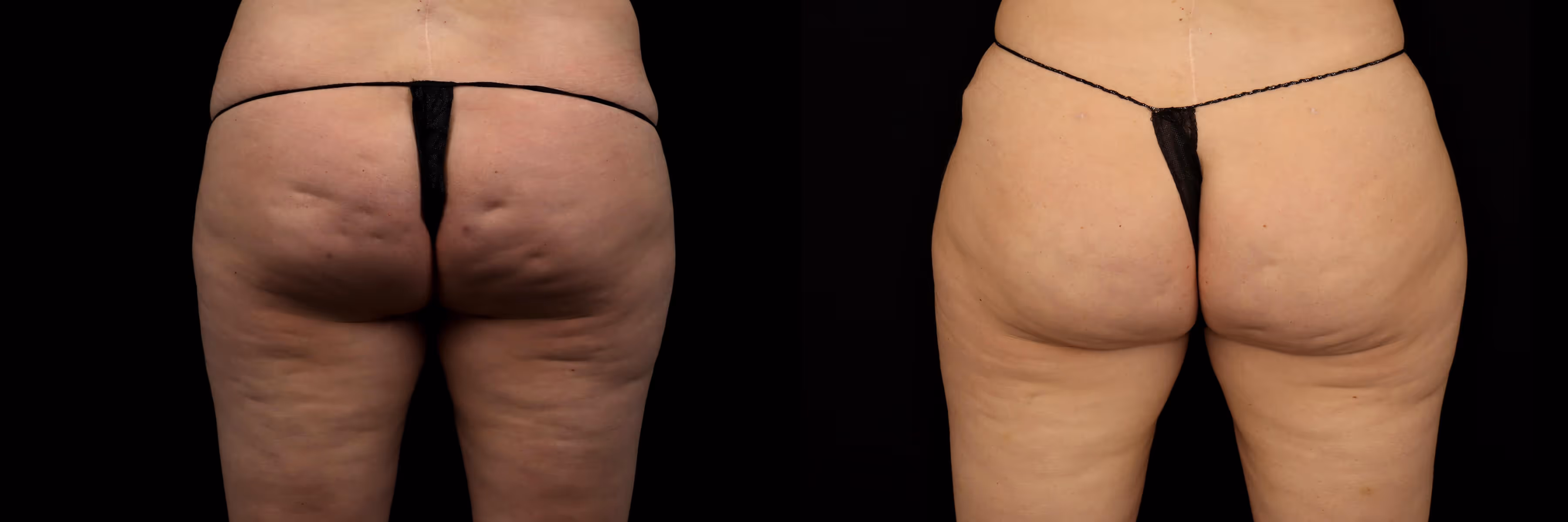 Before And After Patient Image