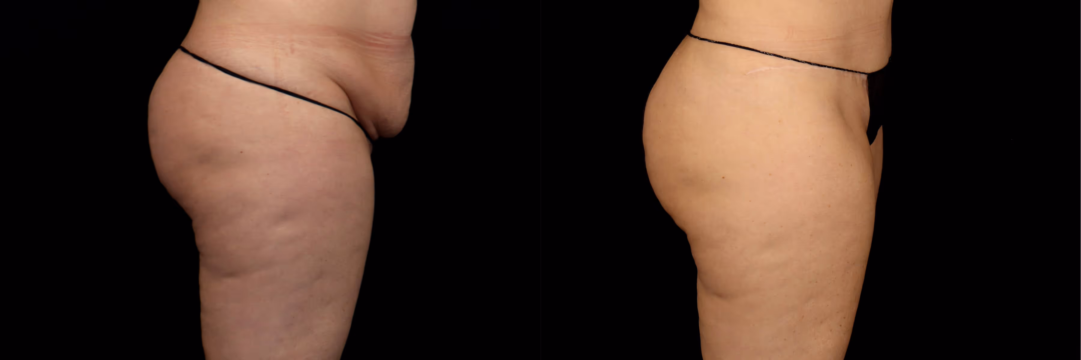 Before And After Patient Image