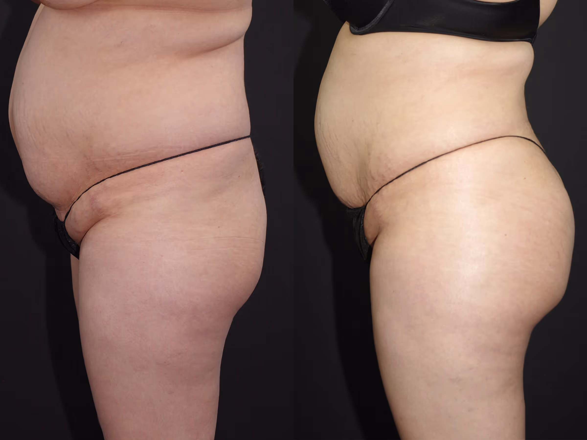 Before And After Patient Image