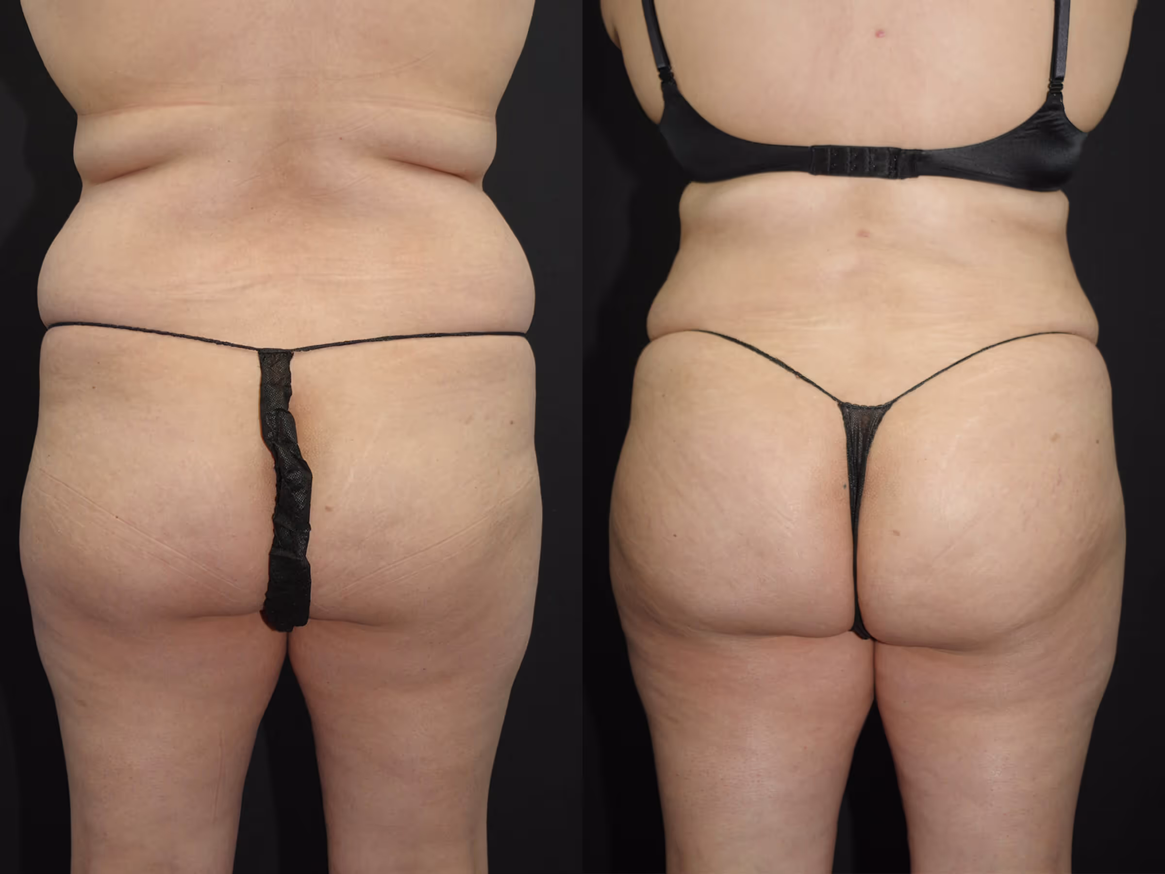 Before And After Patient Image