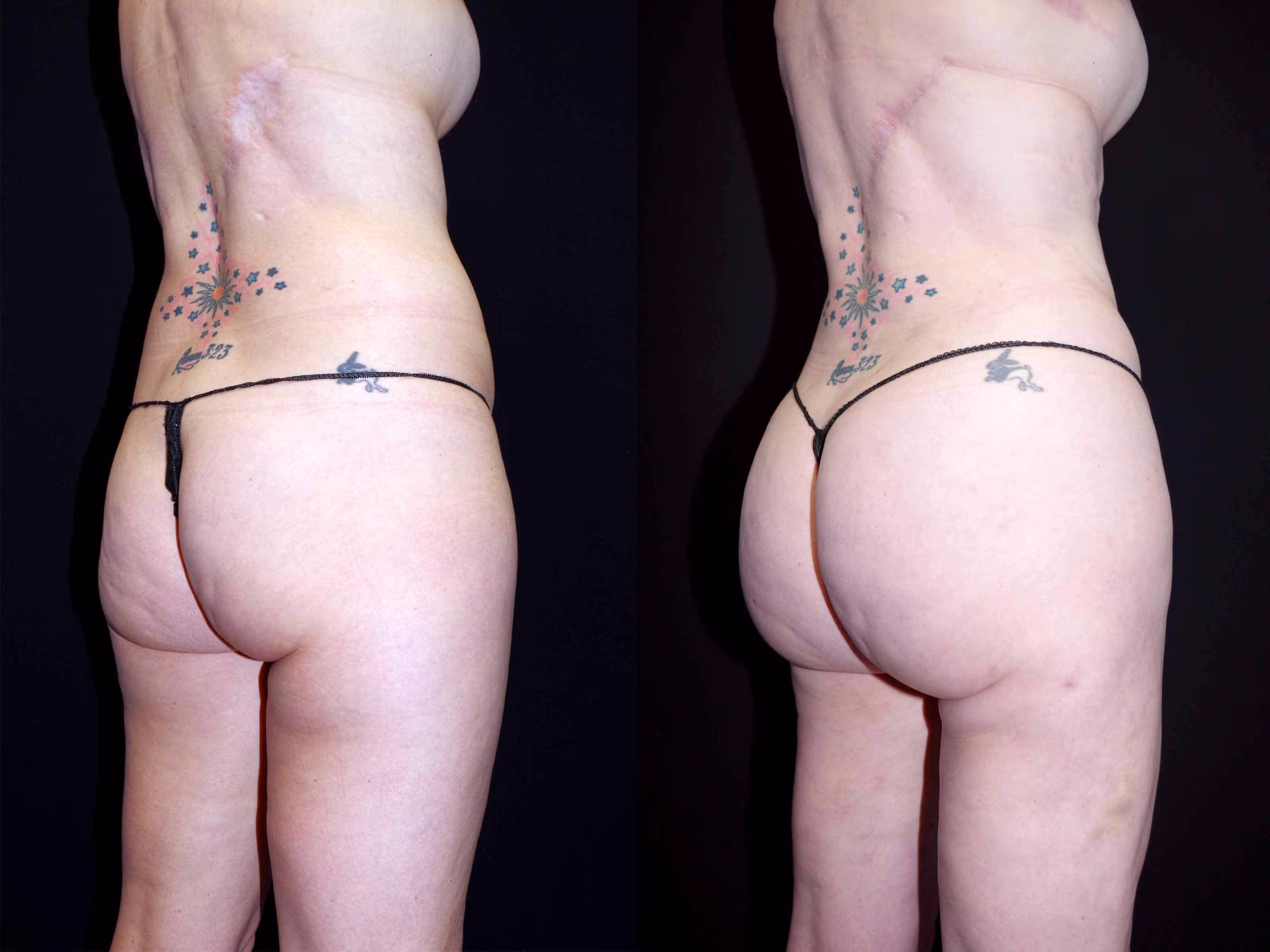 Before And After Patient Image