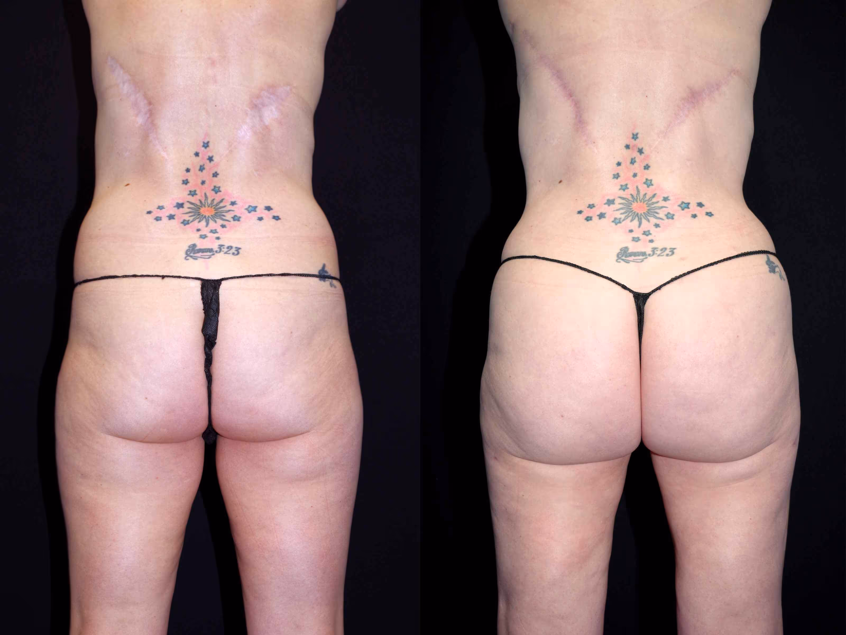 Before And After Patient Image
