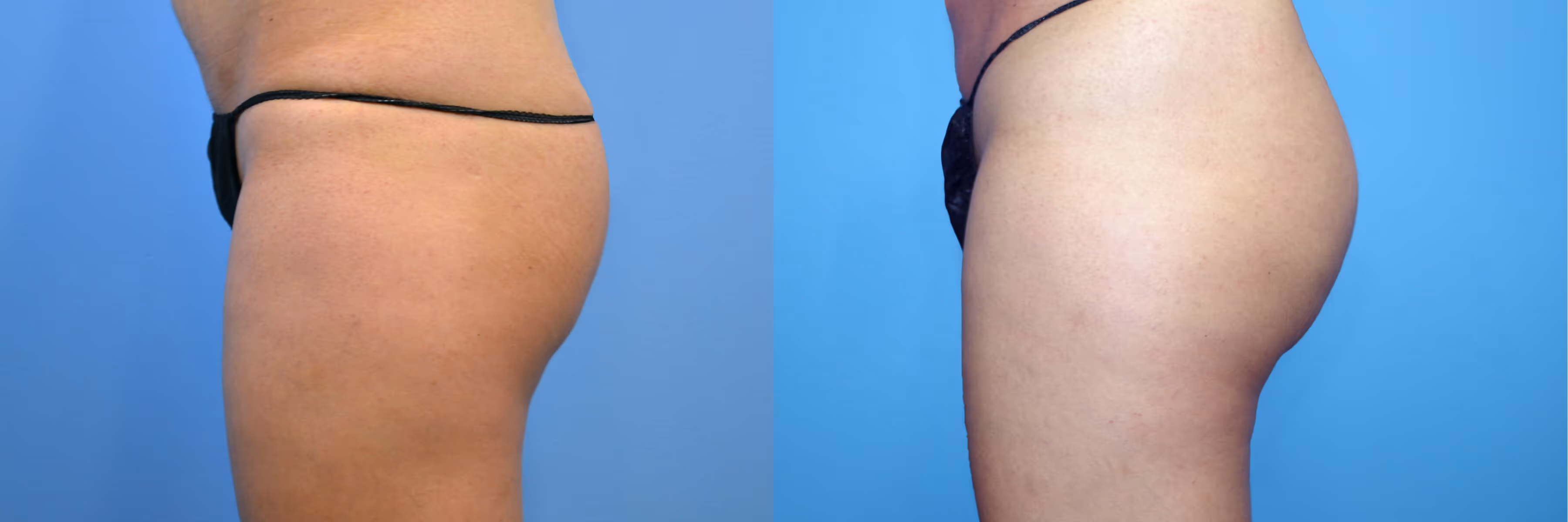 Before And After Patient Image