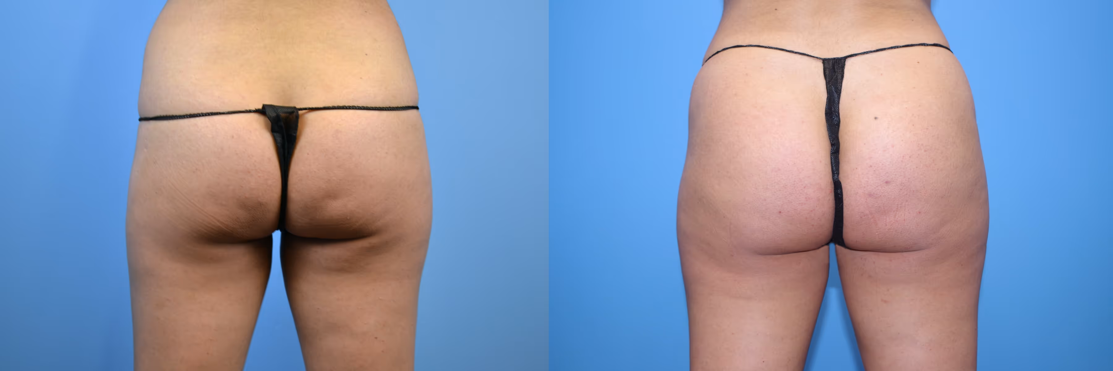Before And After Patient Image