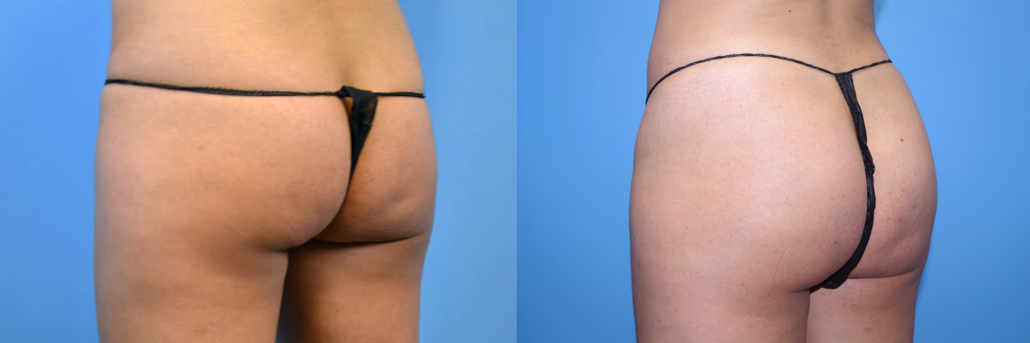 Before And After Patient Image