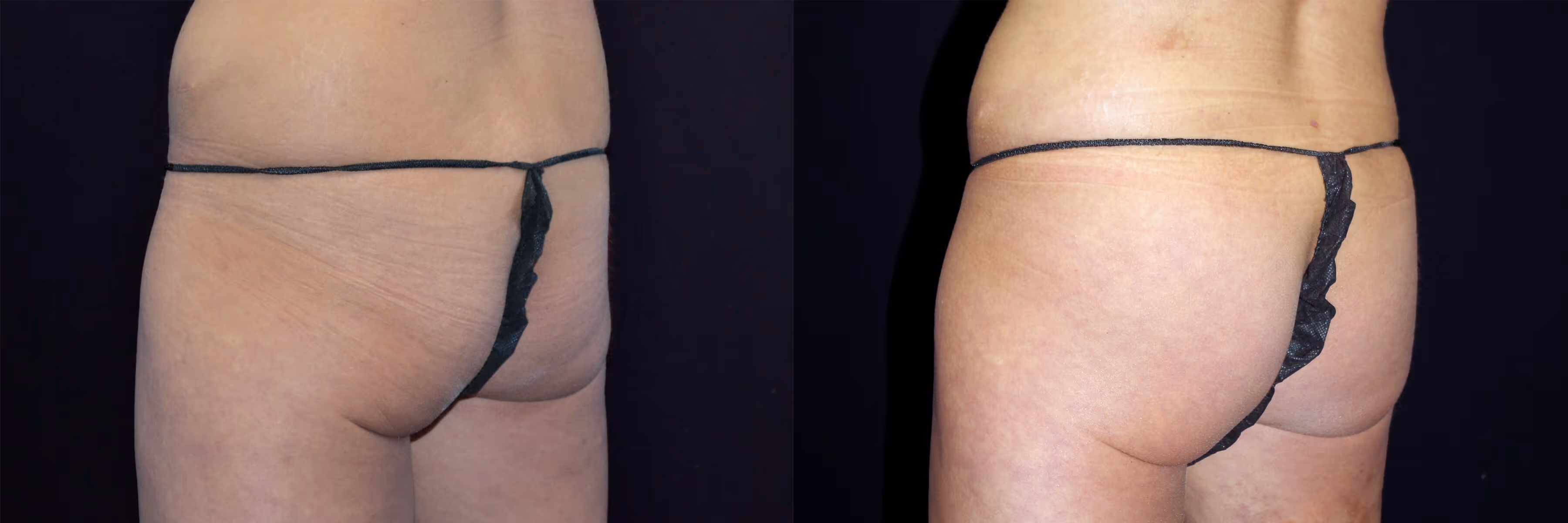 Before And After Patient Image