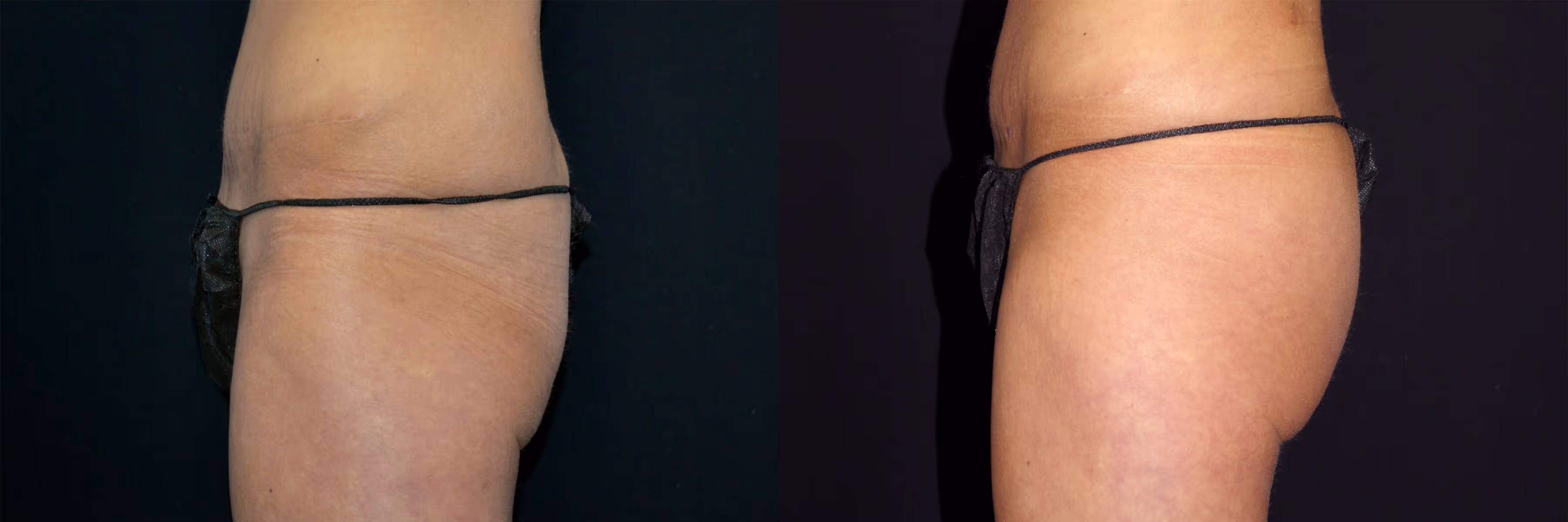 Before And After Patient Image
