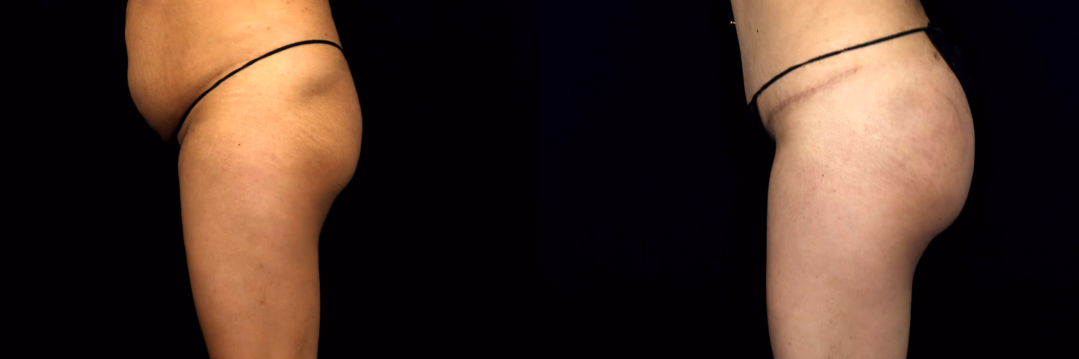 Before And After Patient Image
