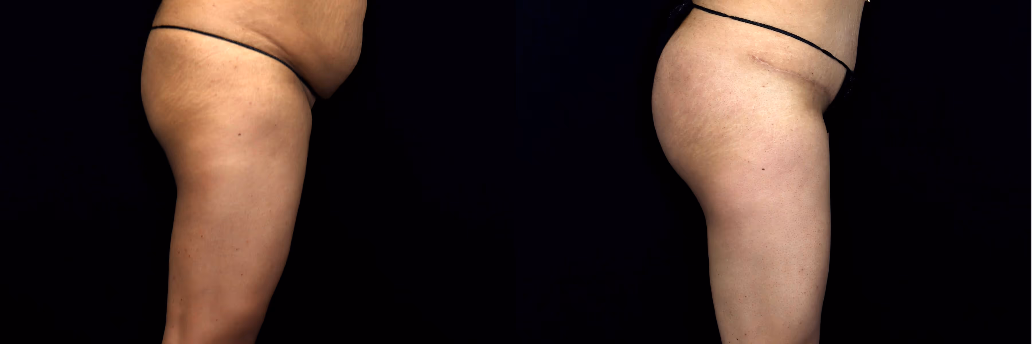 Before And After Patient Image